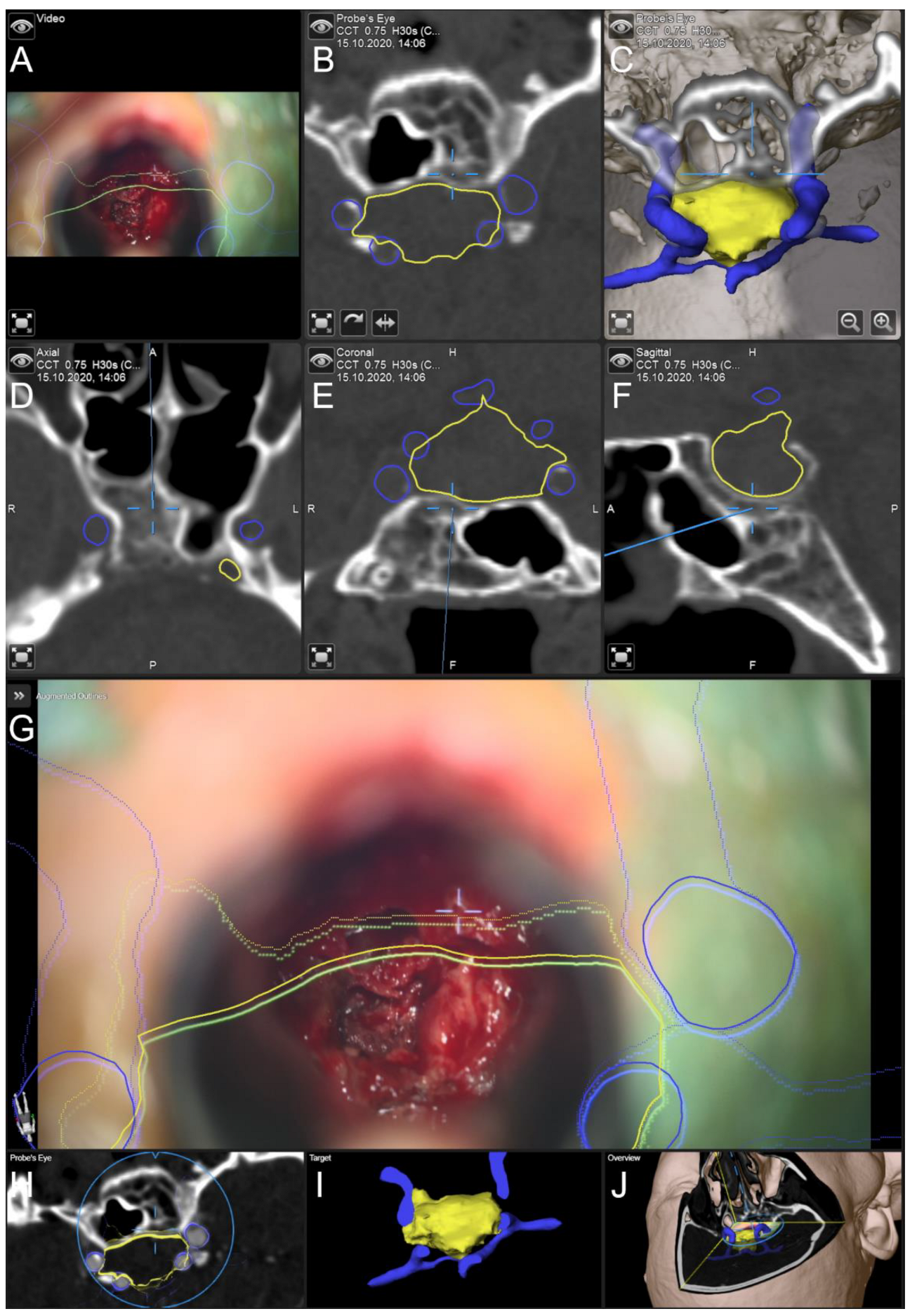 Jcm 11 05590 g004 Jcm 11 05590 g004