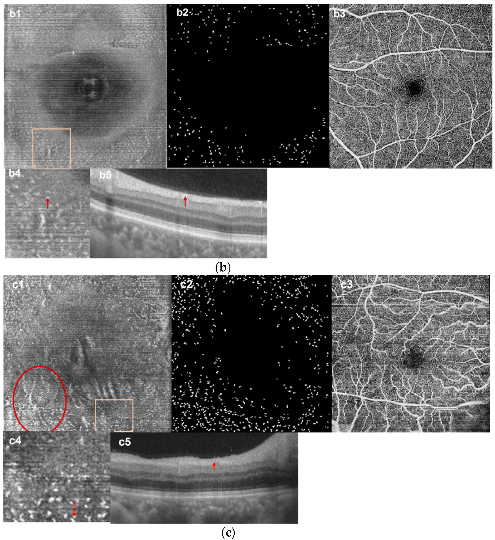Jcm 11 05636 g003b Jcm 11 05636 g003b