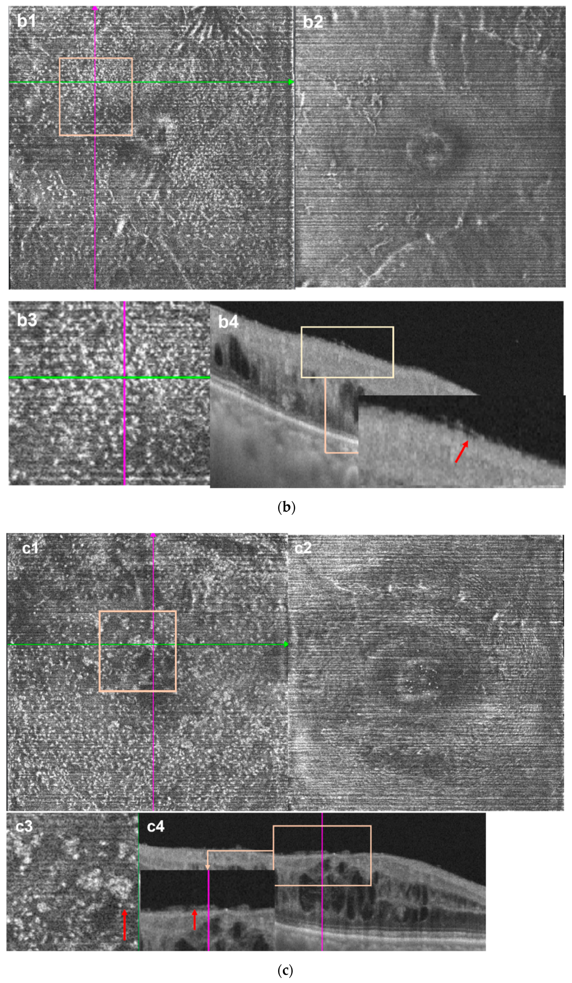 Jcm 11 05636 g004b Jcm 11 05636 g004b