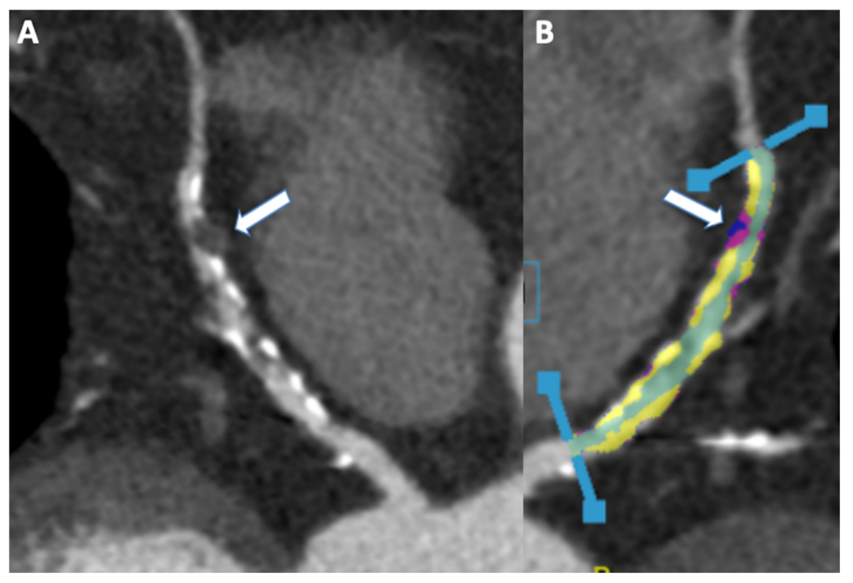Jcm 11 05663 g005 Jcm 11 05663 g005