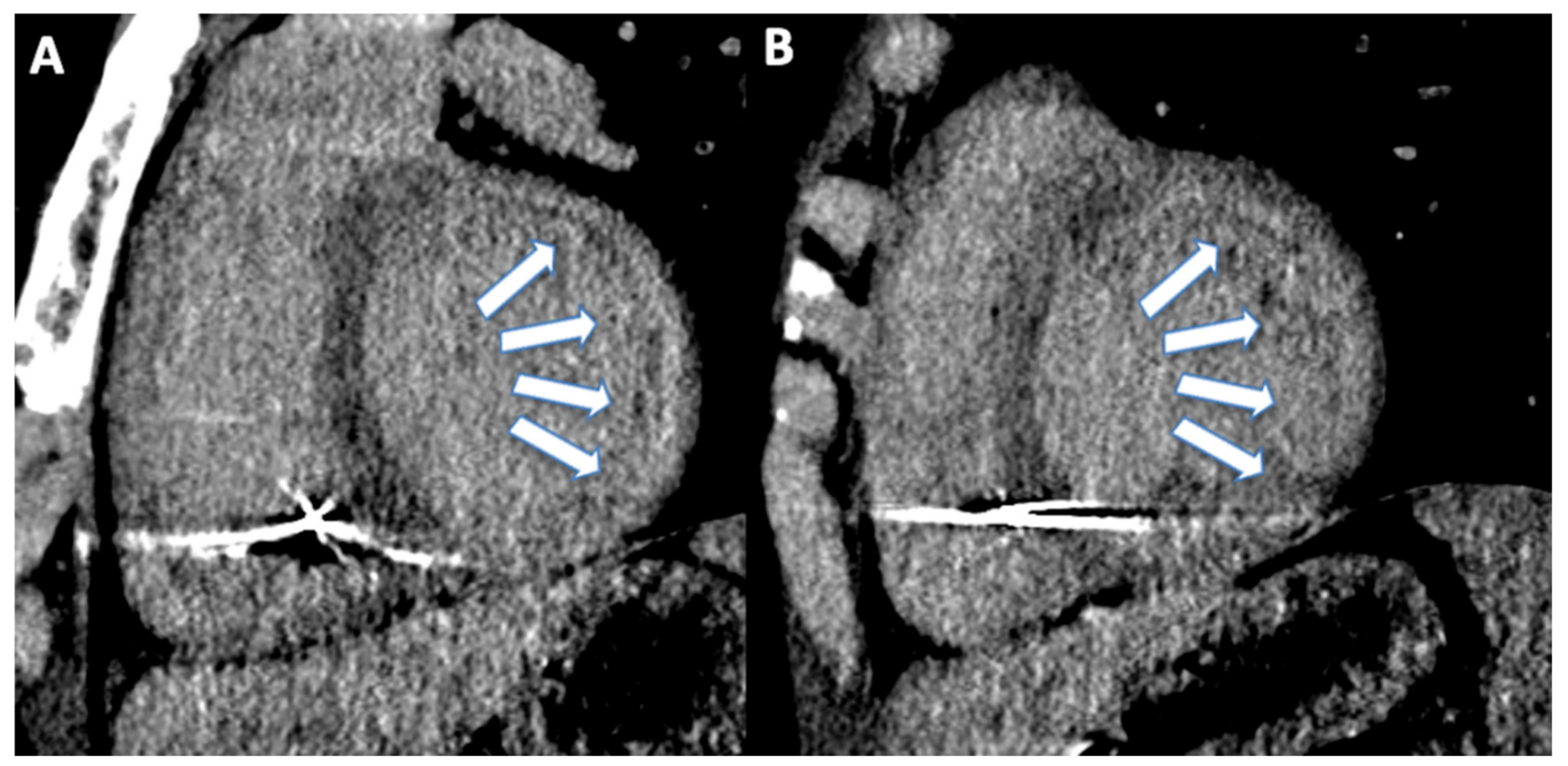 Jcm 11 05663 g006 Jcm 11 05663 g006