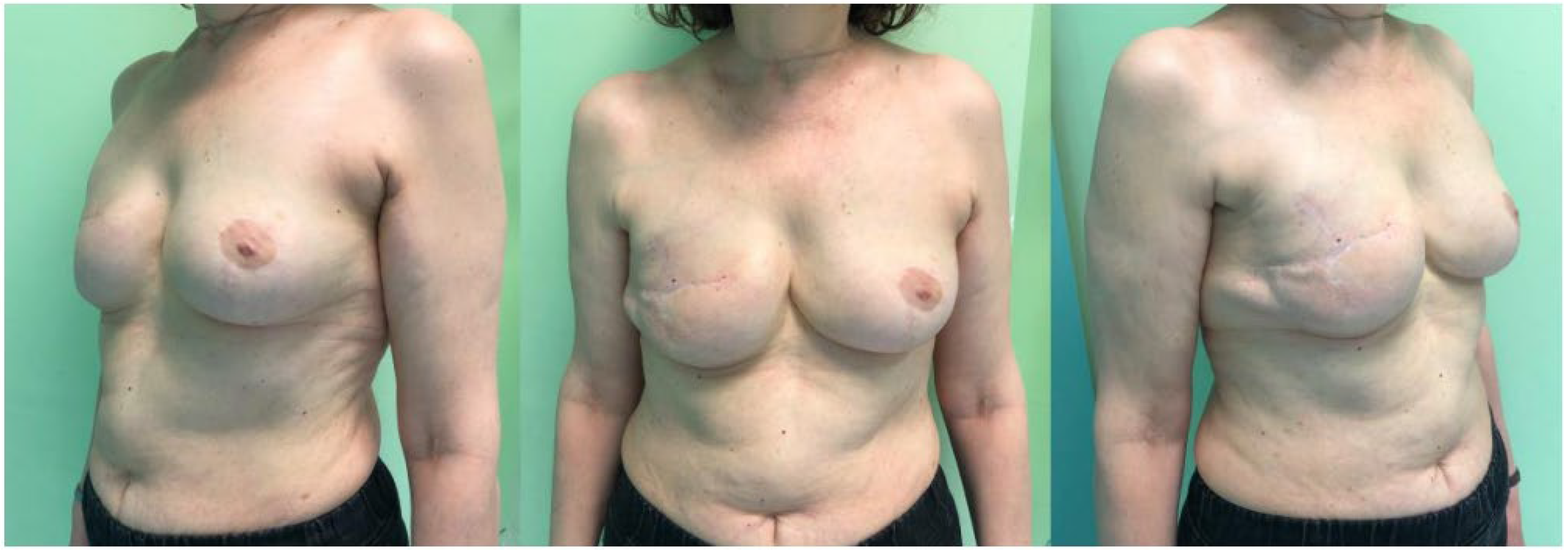 Jcm 11 05856 g003 Jcm 11 05856 g003