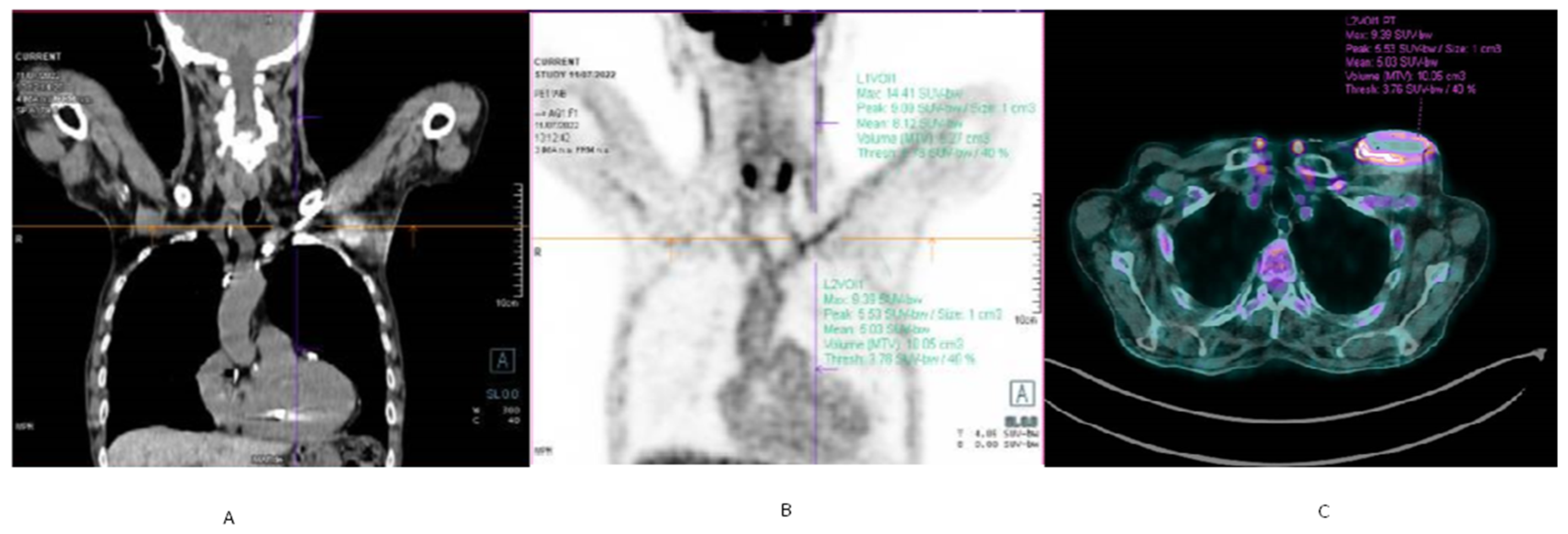 Jcm 11 05898 g004 Jcm 11 05898 g004