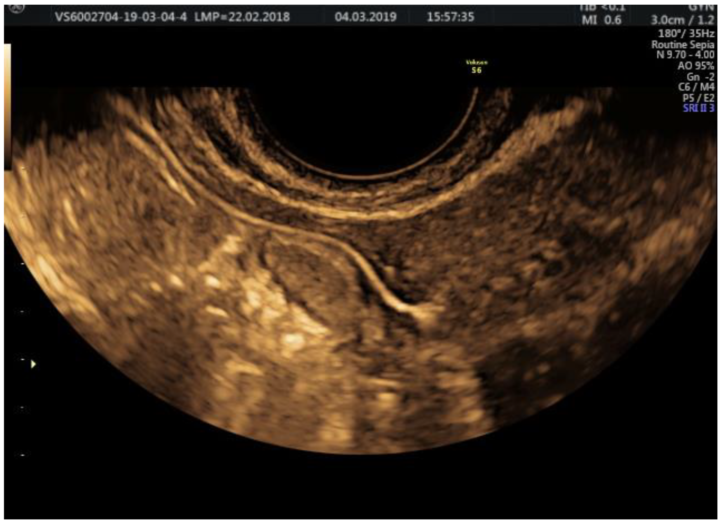 Jcm 11 05946 g005 Jcm 11 05946 g005