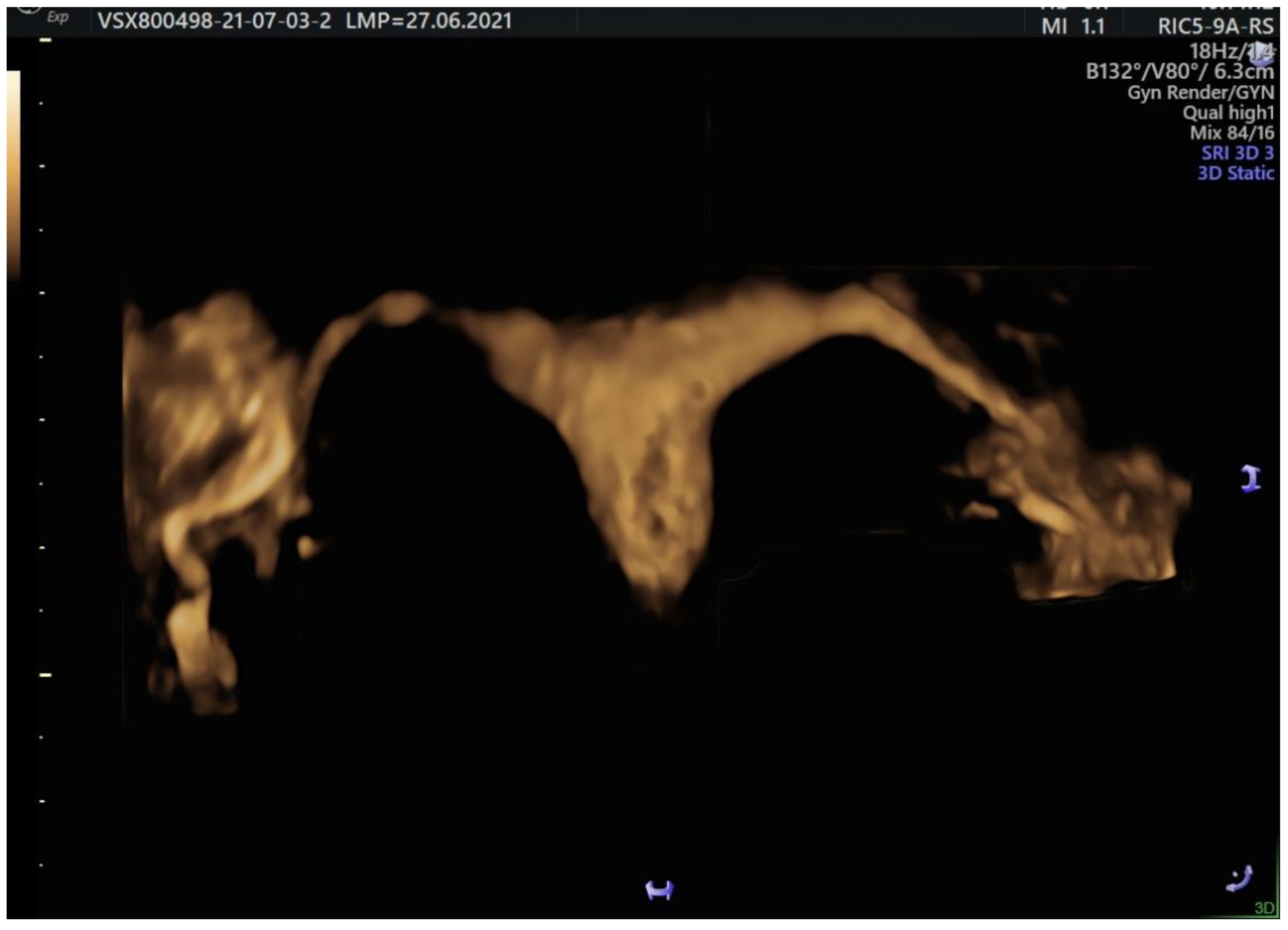 Jcm 11 05946 g011 Jcm 11 05946 g011