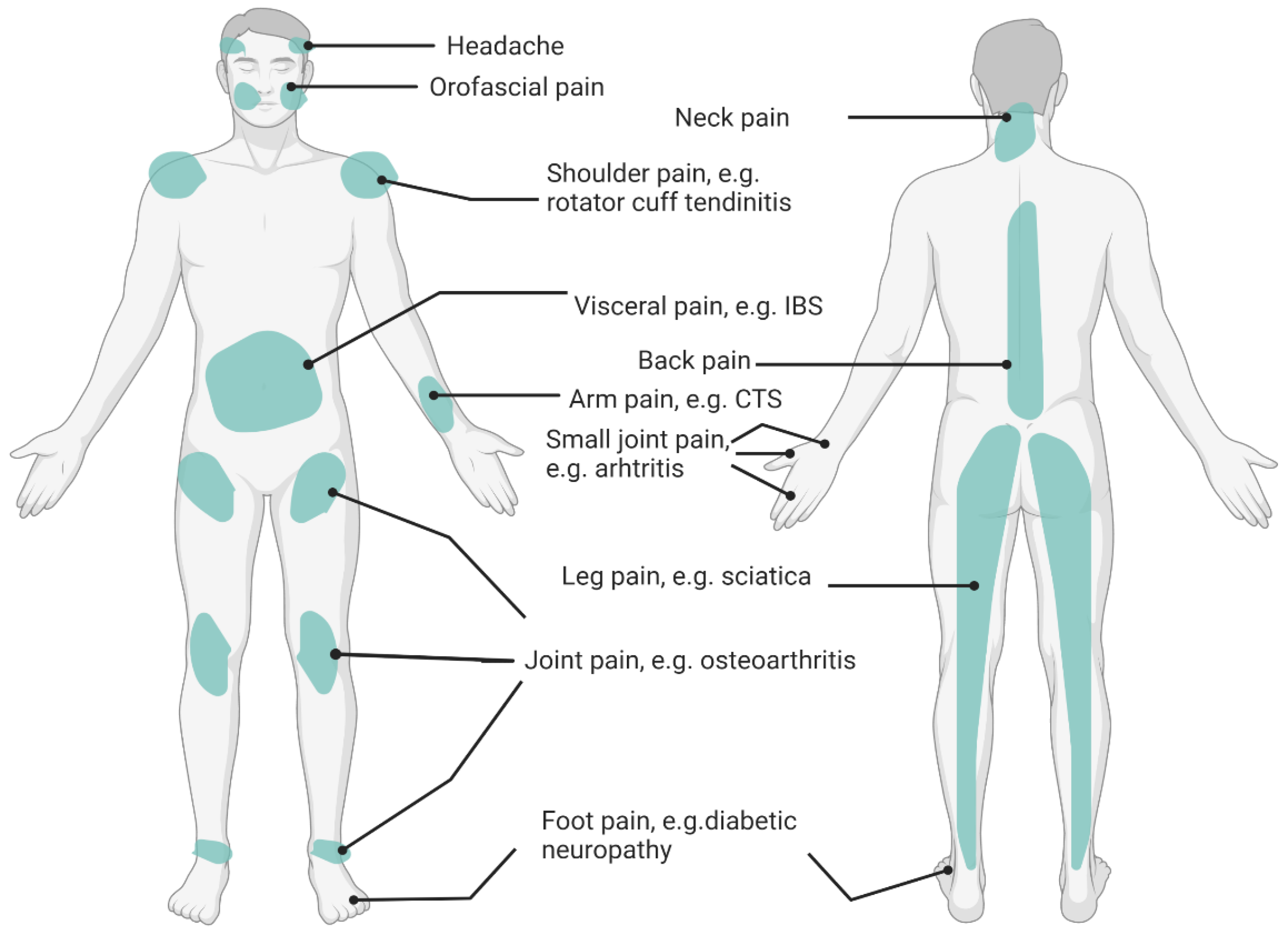 Dietitians Online Blog: World Arthritis Day - Cooking Tips for People with  Arthritis