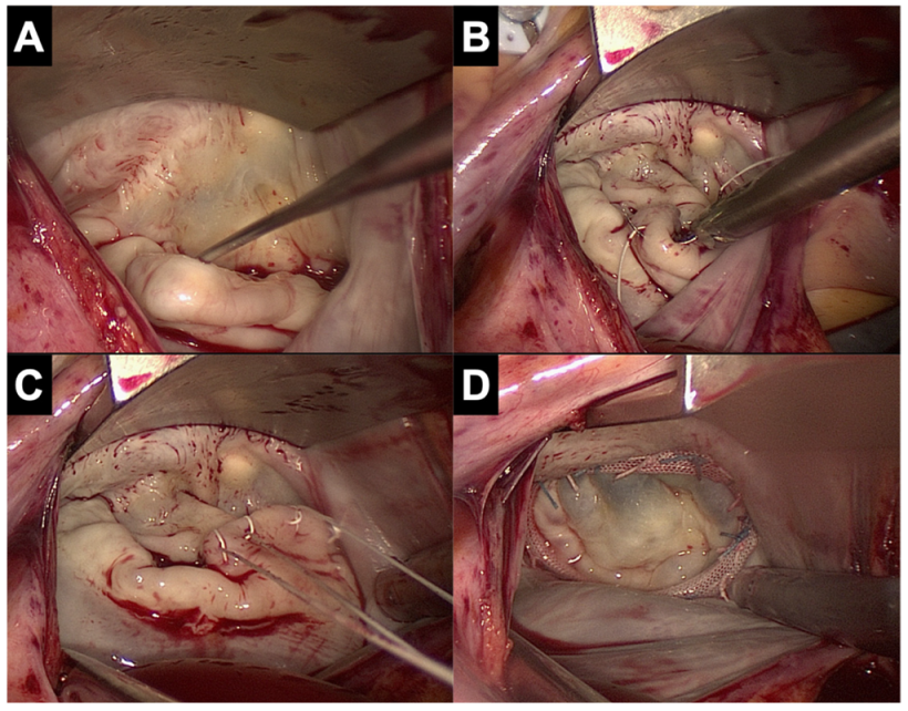 Jcm 11 05993 g002 Jcm 11 05993 g002