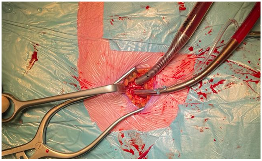 Jcm 11 05993 g004 Jcm 11 05993 g004