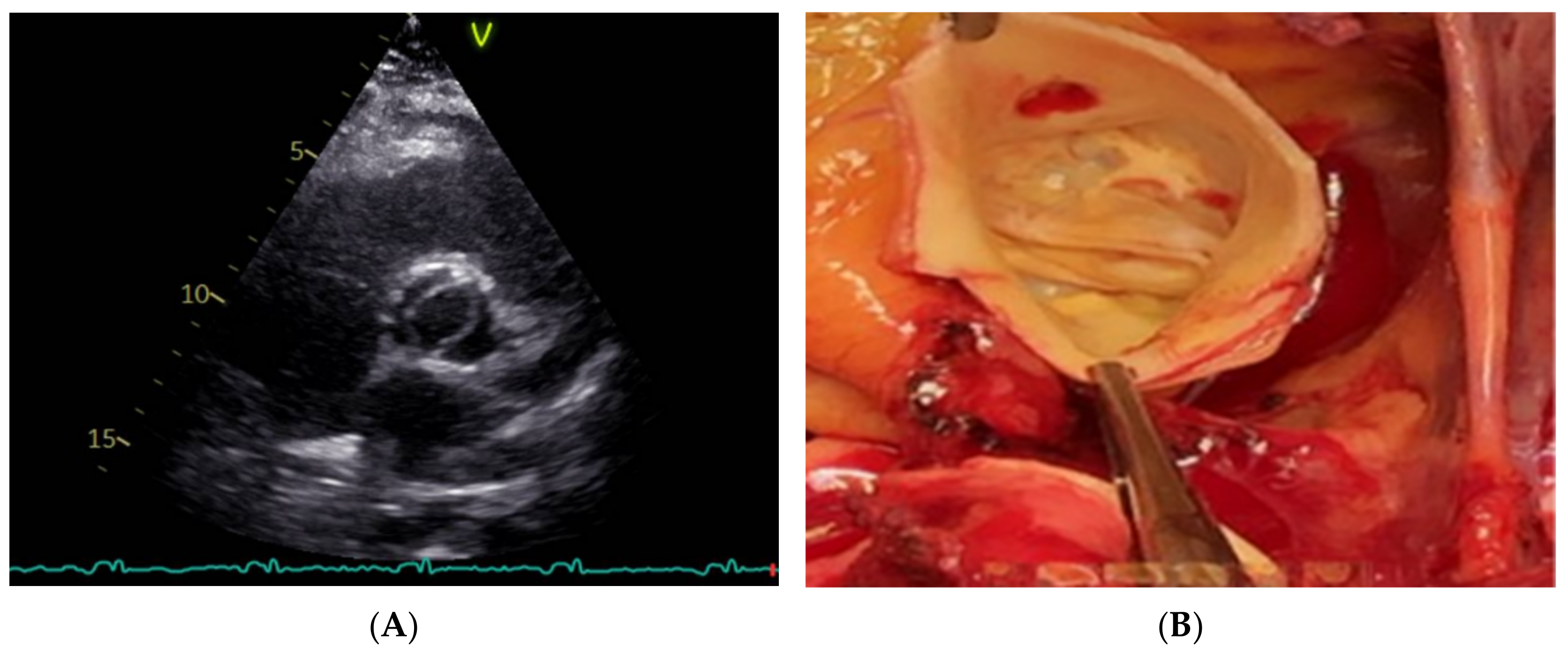 Jcm 11 06002 g007 Jcm 11 06002 g007