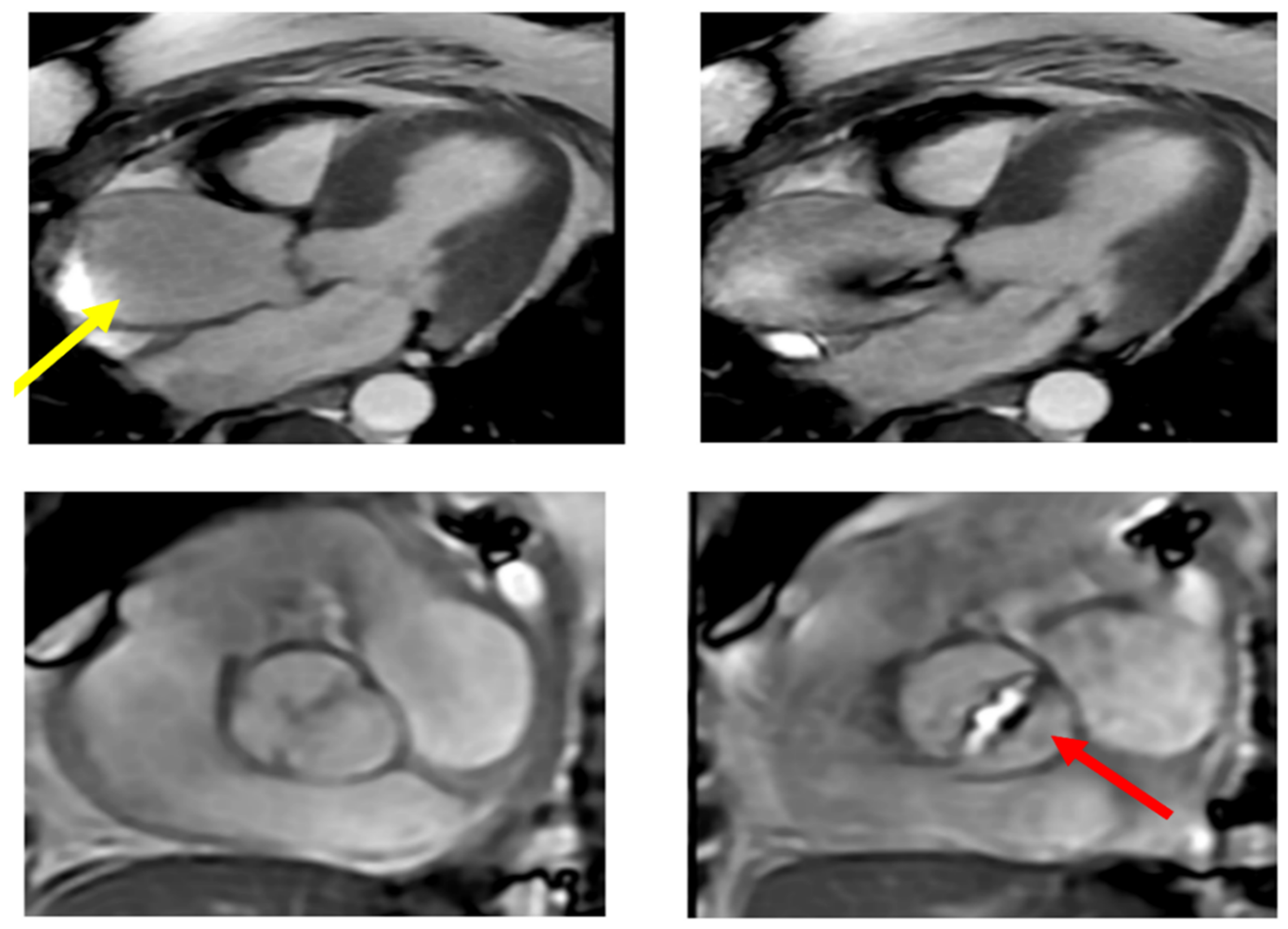 Jcm 11 06002 g009 Jcm 11 06002 g009