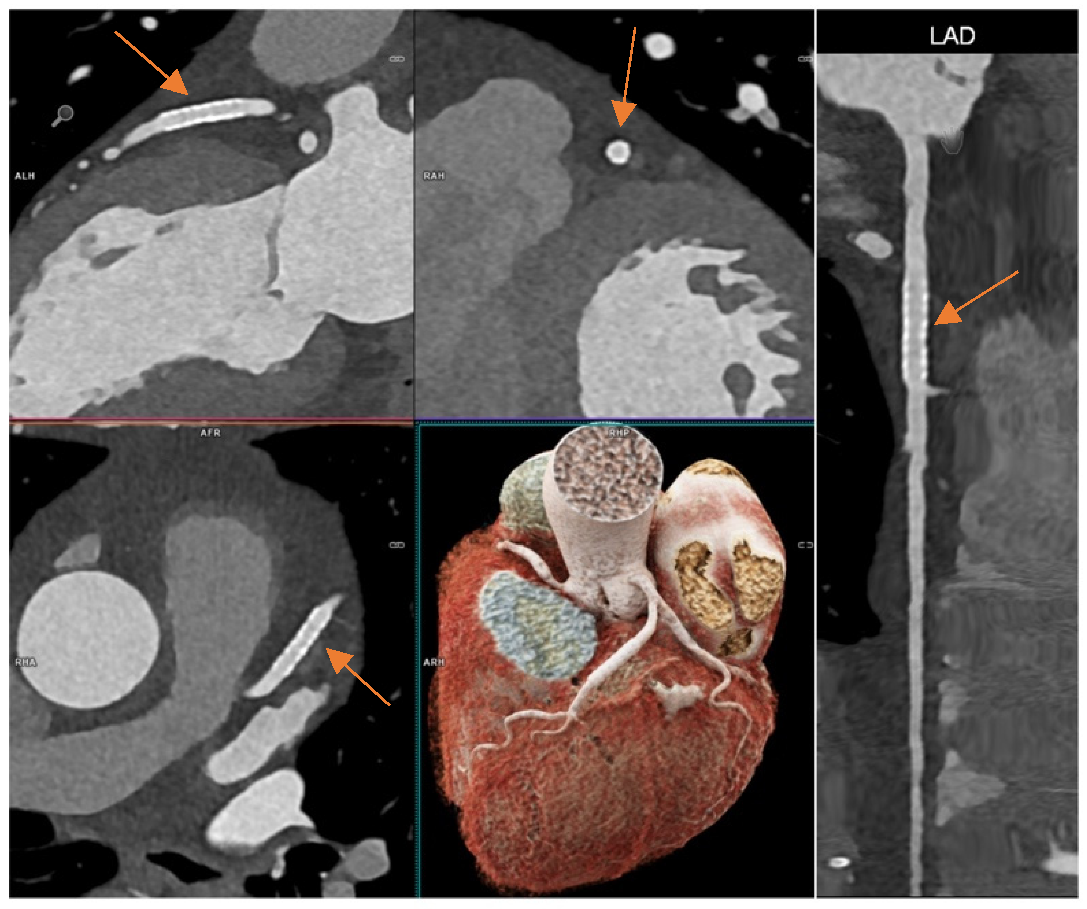 JCM | Free Full-Text | High Temporal Resolution Dual-Source Photon ...
