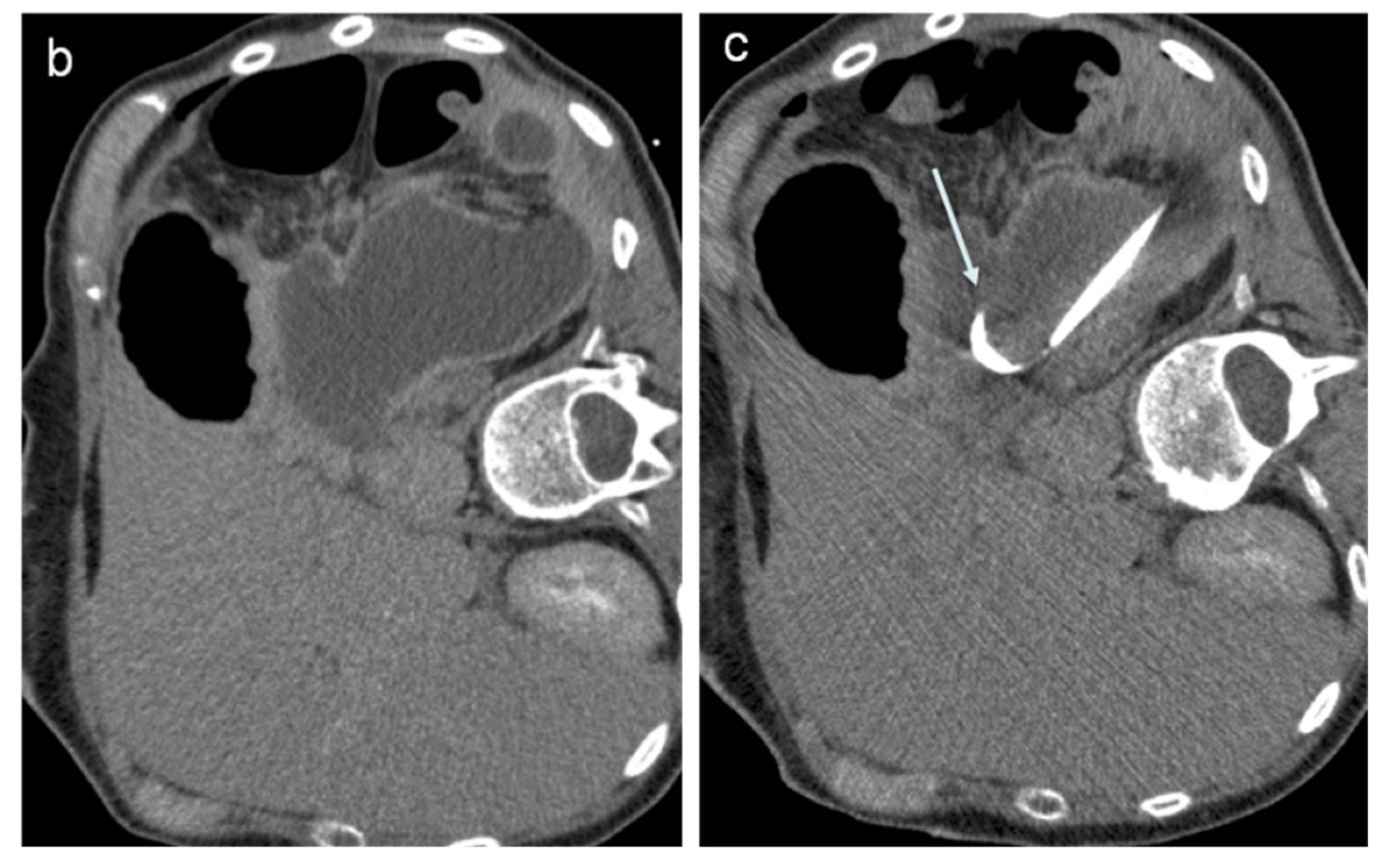 Jcm 11 06005 g002b Jcm 11 06005 g002b