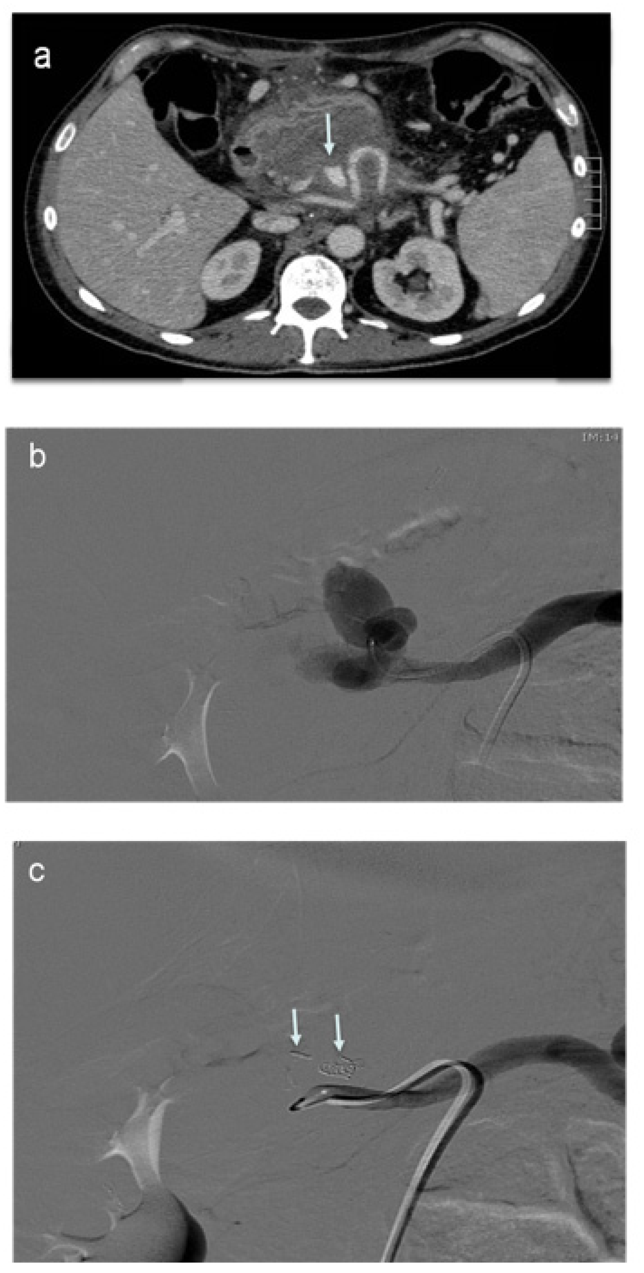 Jcm 11 06005 g005 Jcm 11 06005 g005