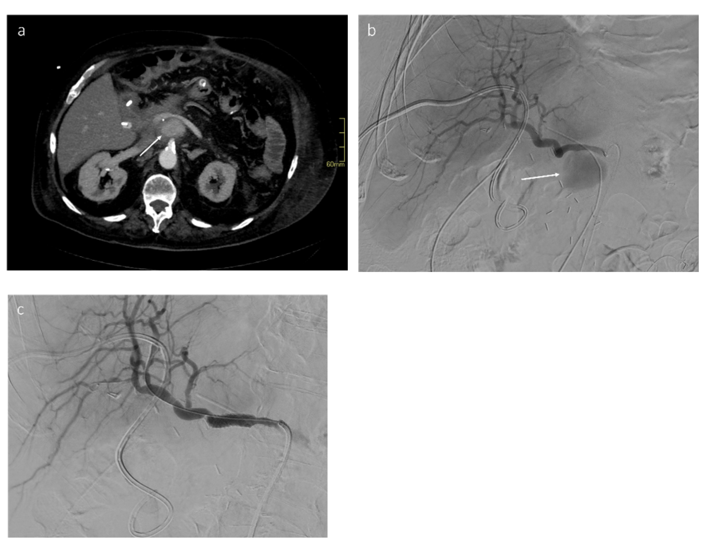 Jcm 11 06005 g006 Jcm 11 06005 g006