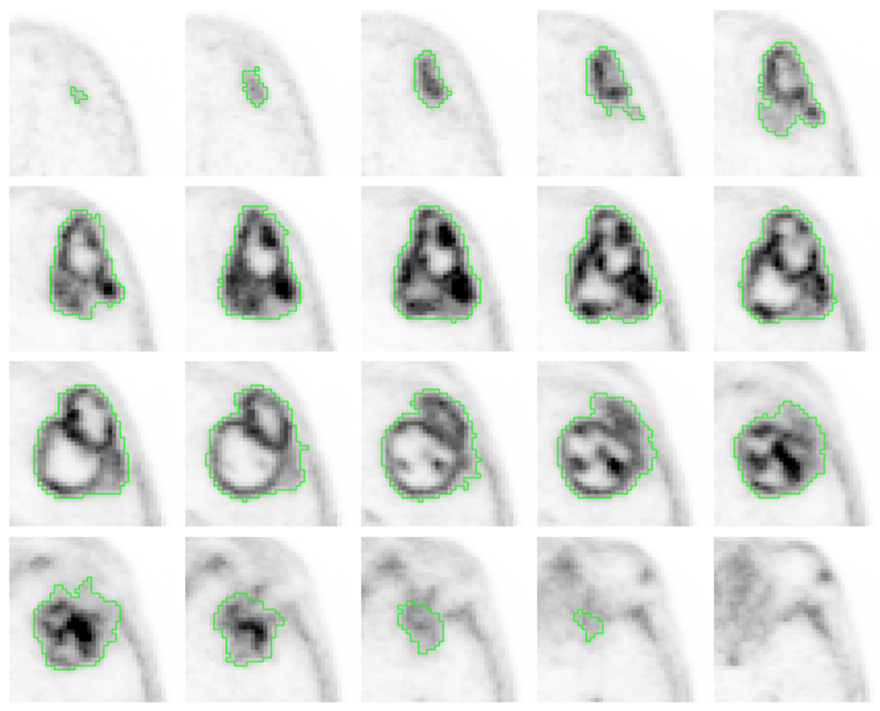 Jcm 11 06065 g005 Jcm 11 06065 g005