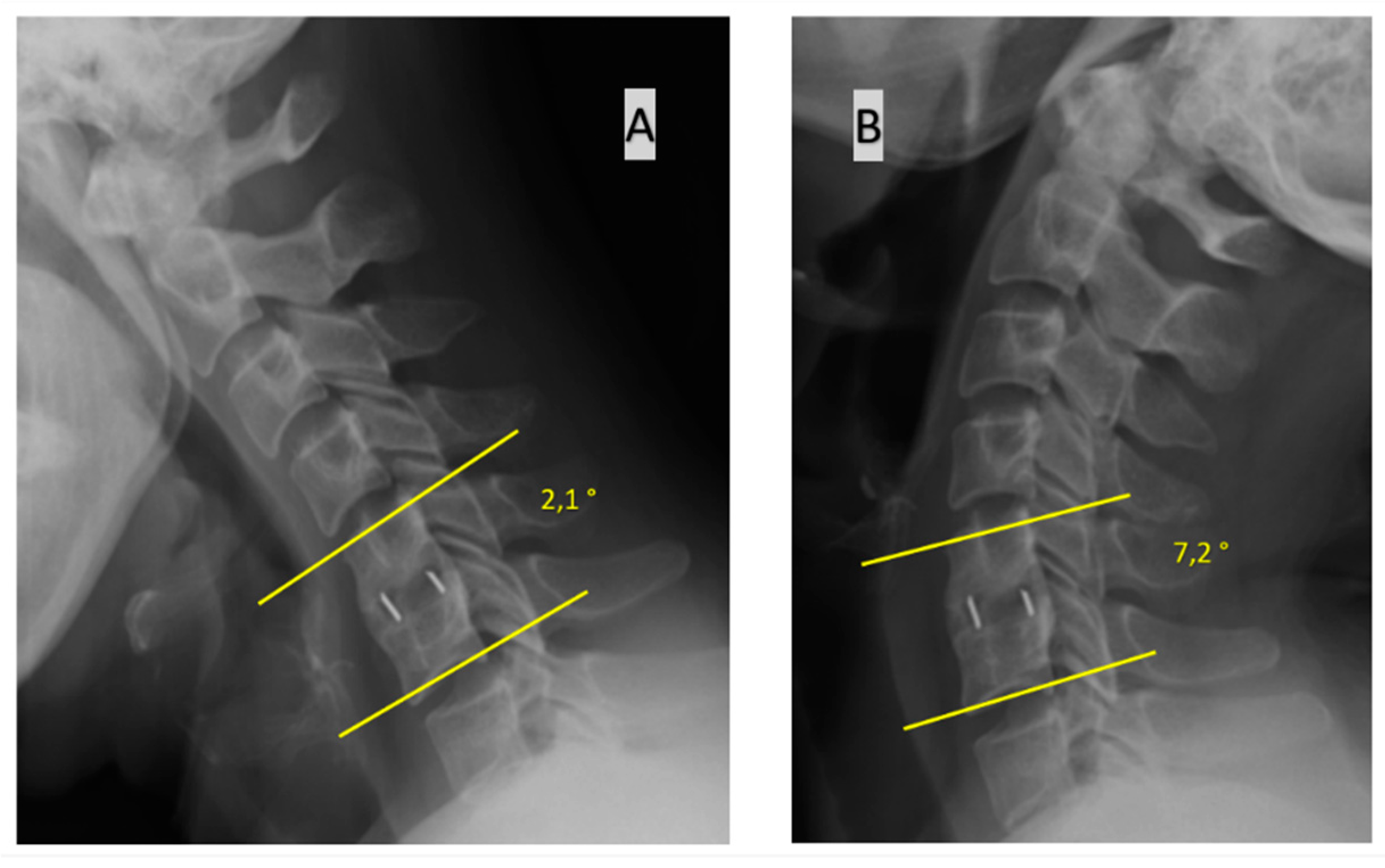 JCM Free FullText Reliability and Utility of Various Methods for Evaluation of Bone Union