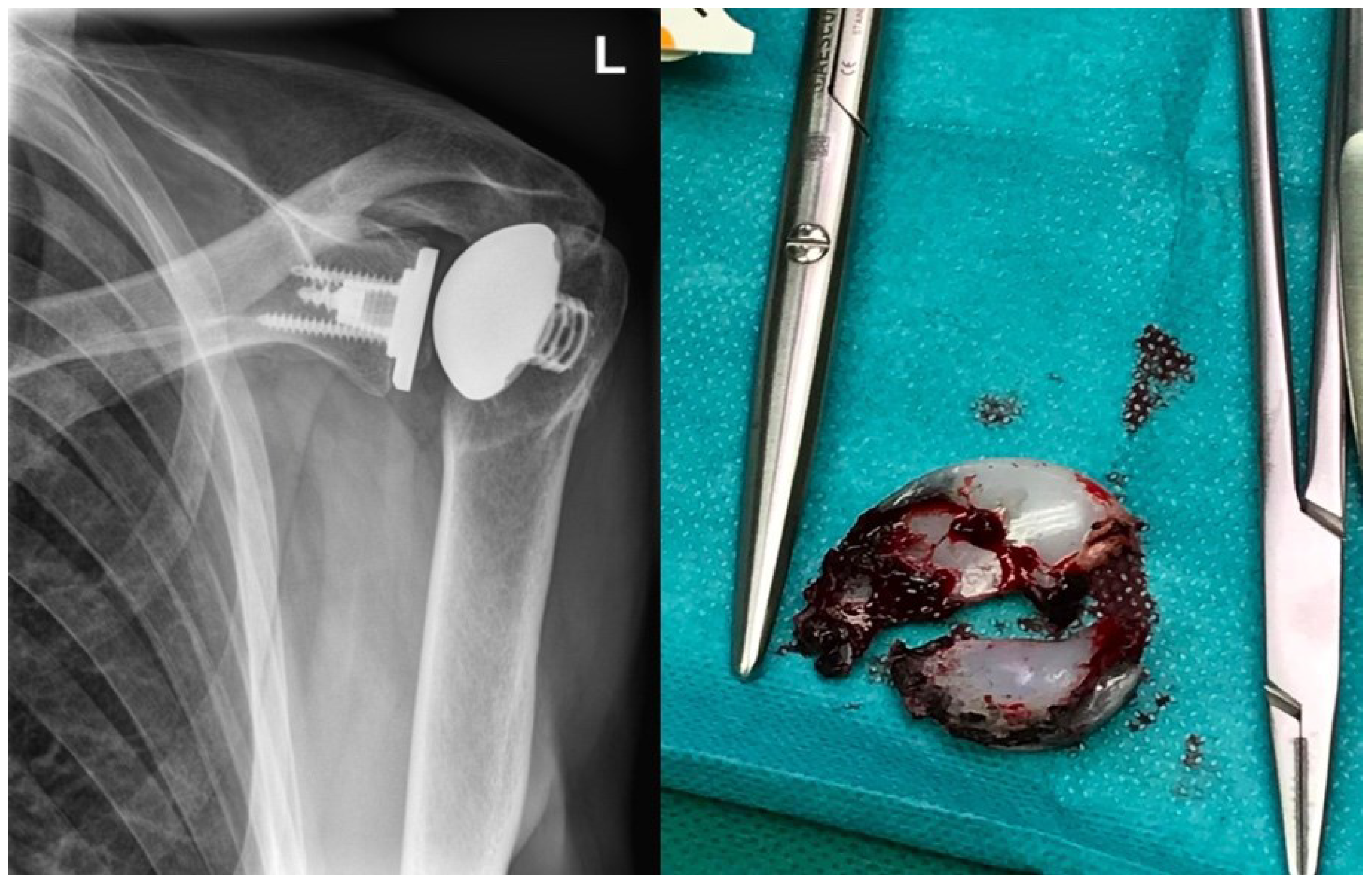 Jcm 11 06107 g005 Jcm 11 06107 g005