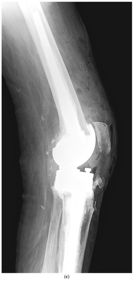 Jcm 11 06128 g001b 550