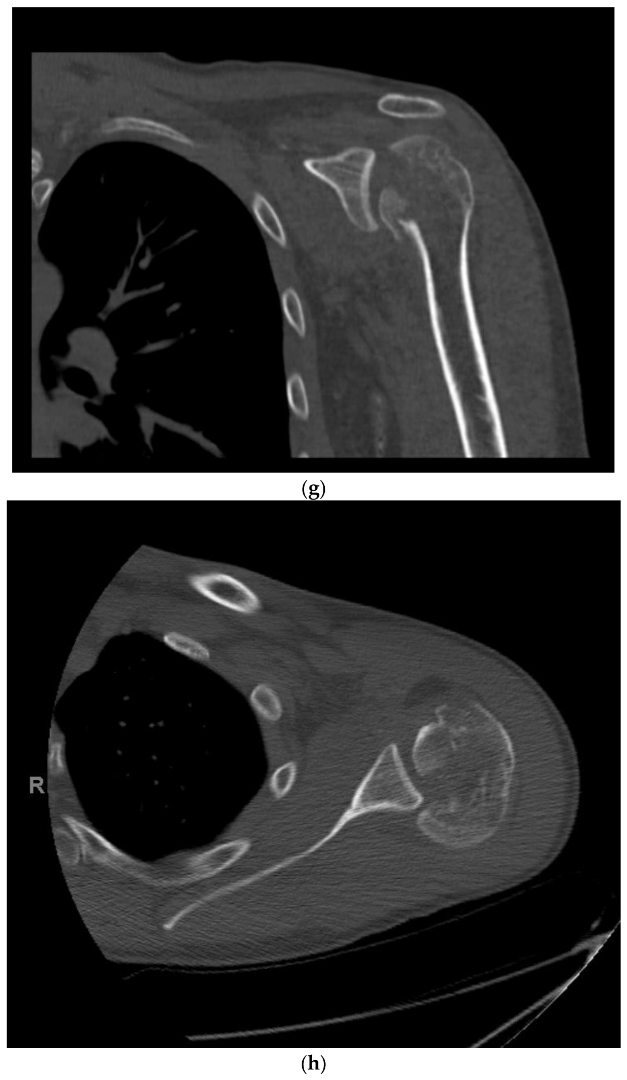 Jcm 11 06140 g001d Jcm 11 06140 g001d