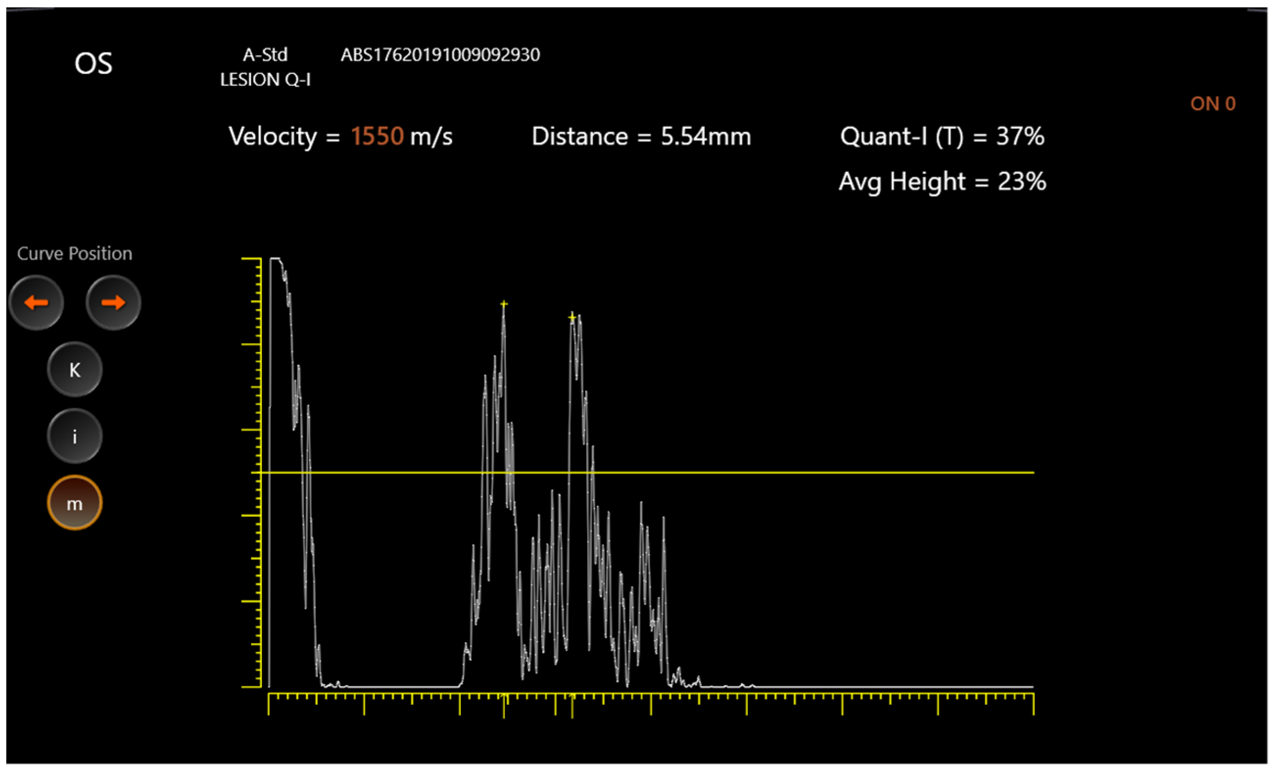 Jcm 11 06153 g001 Jcm 11 06153 g001
