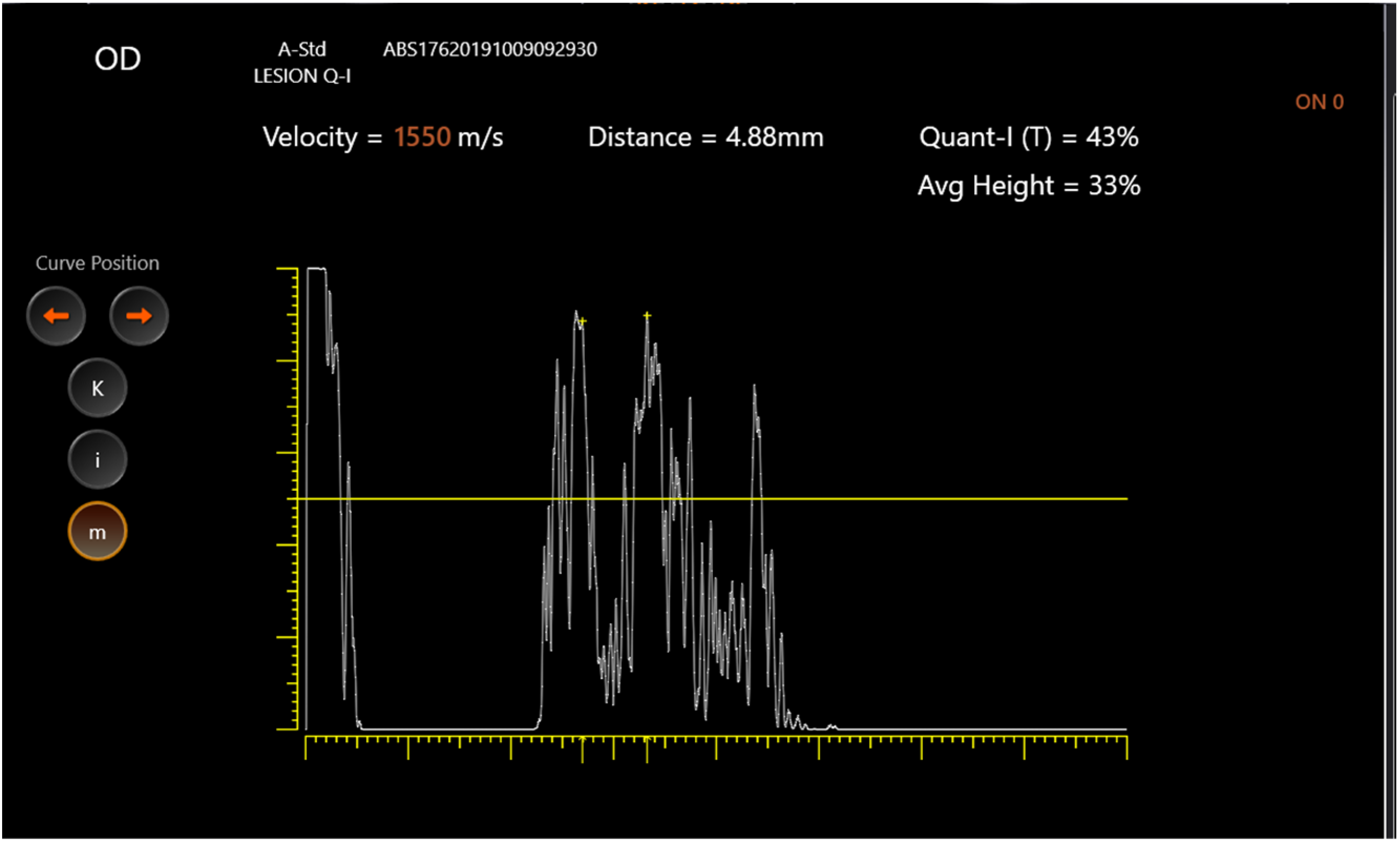 Jcm 11 06153 g002 Jcm 11 06153 g002
