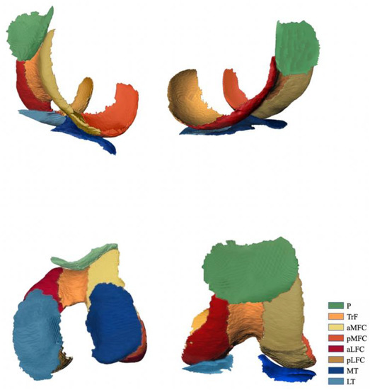 JCM Free FullText Knee Cartilage Change within 5 Years after Aclr