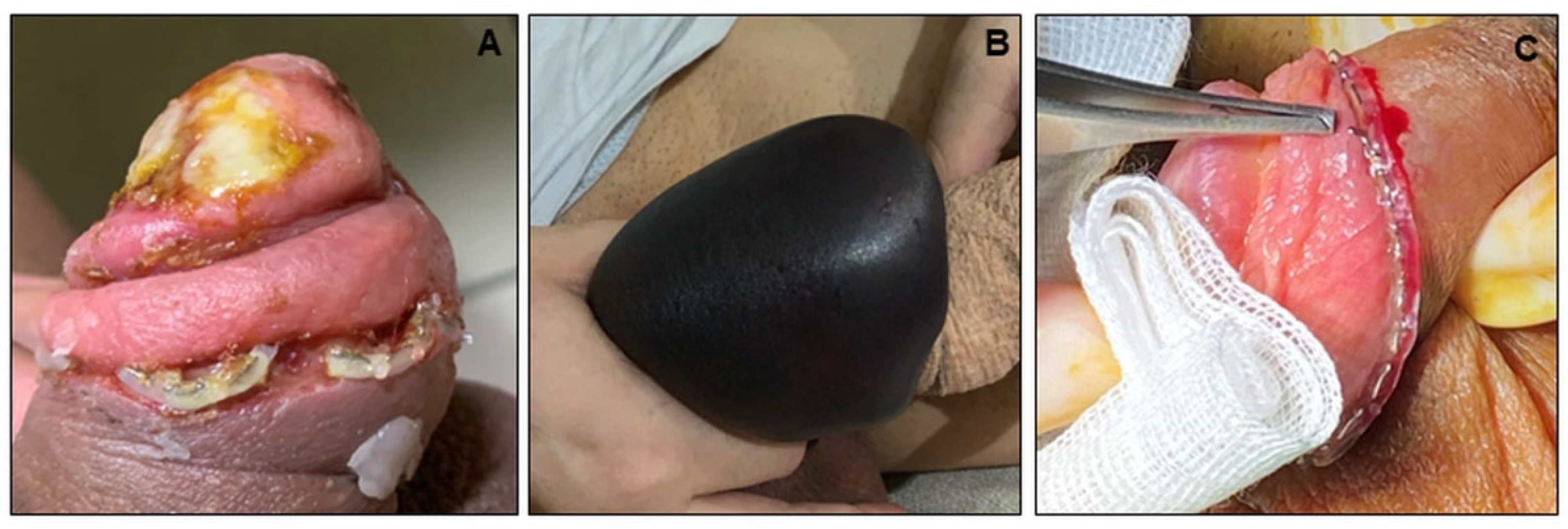 Jcm 11 06206 g002 Jcm 11 06206 g002