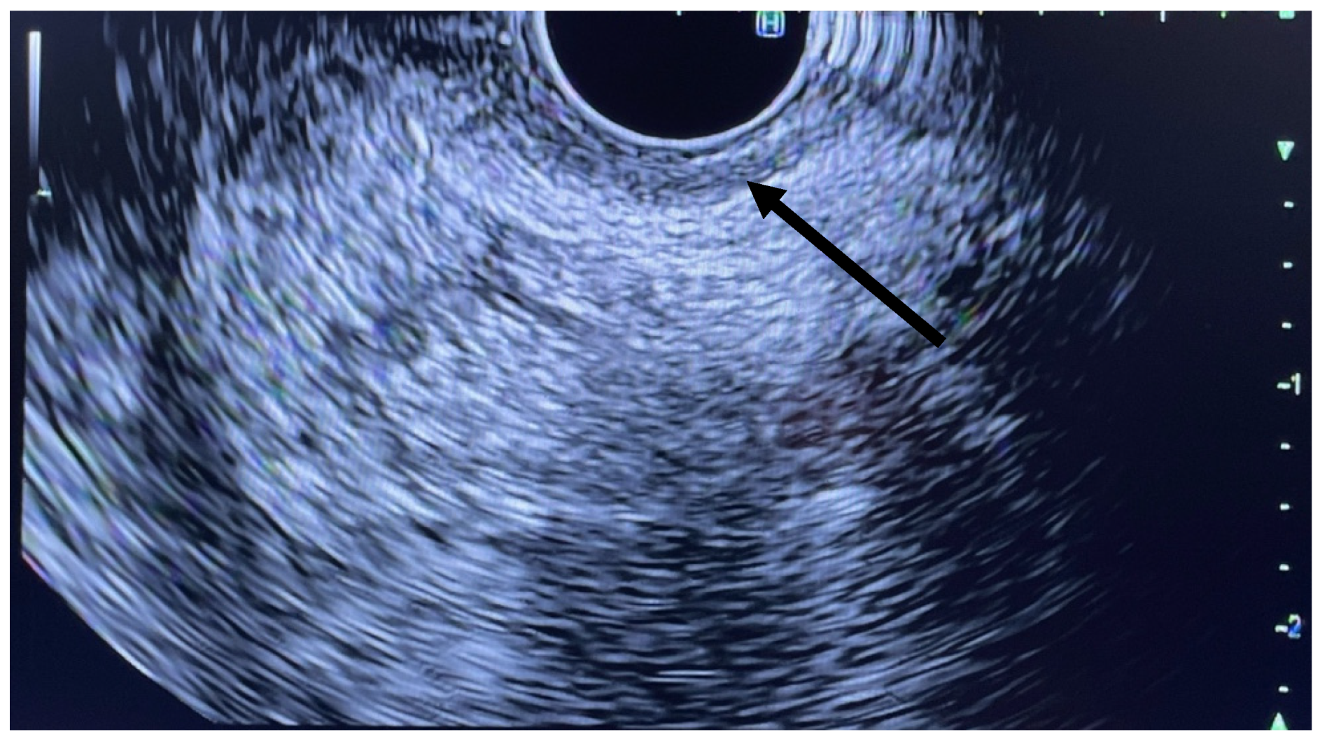 Jcm 11 06207 g002 550