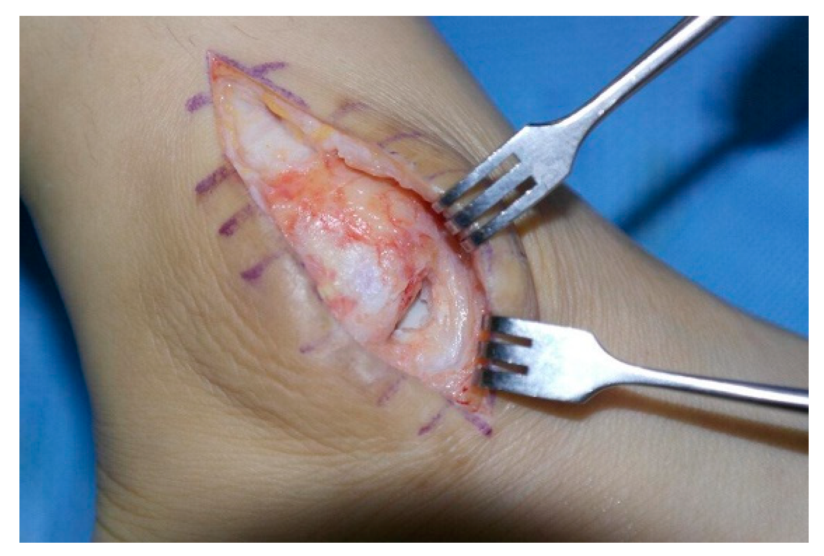 Jcm 11 06215 g004 Jcm 11 06215 g004