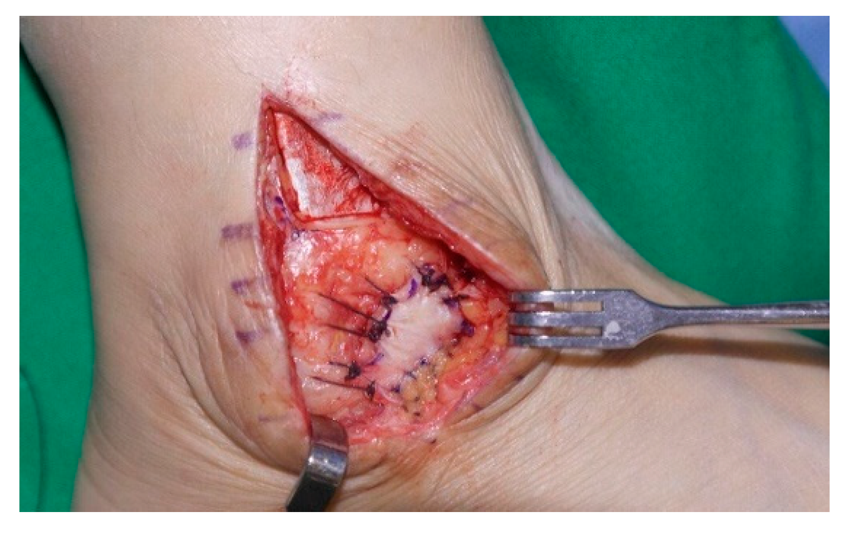 Jcm 11 06215 g005 Jcm 11 06215 g005