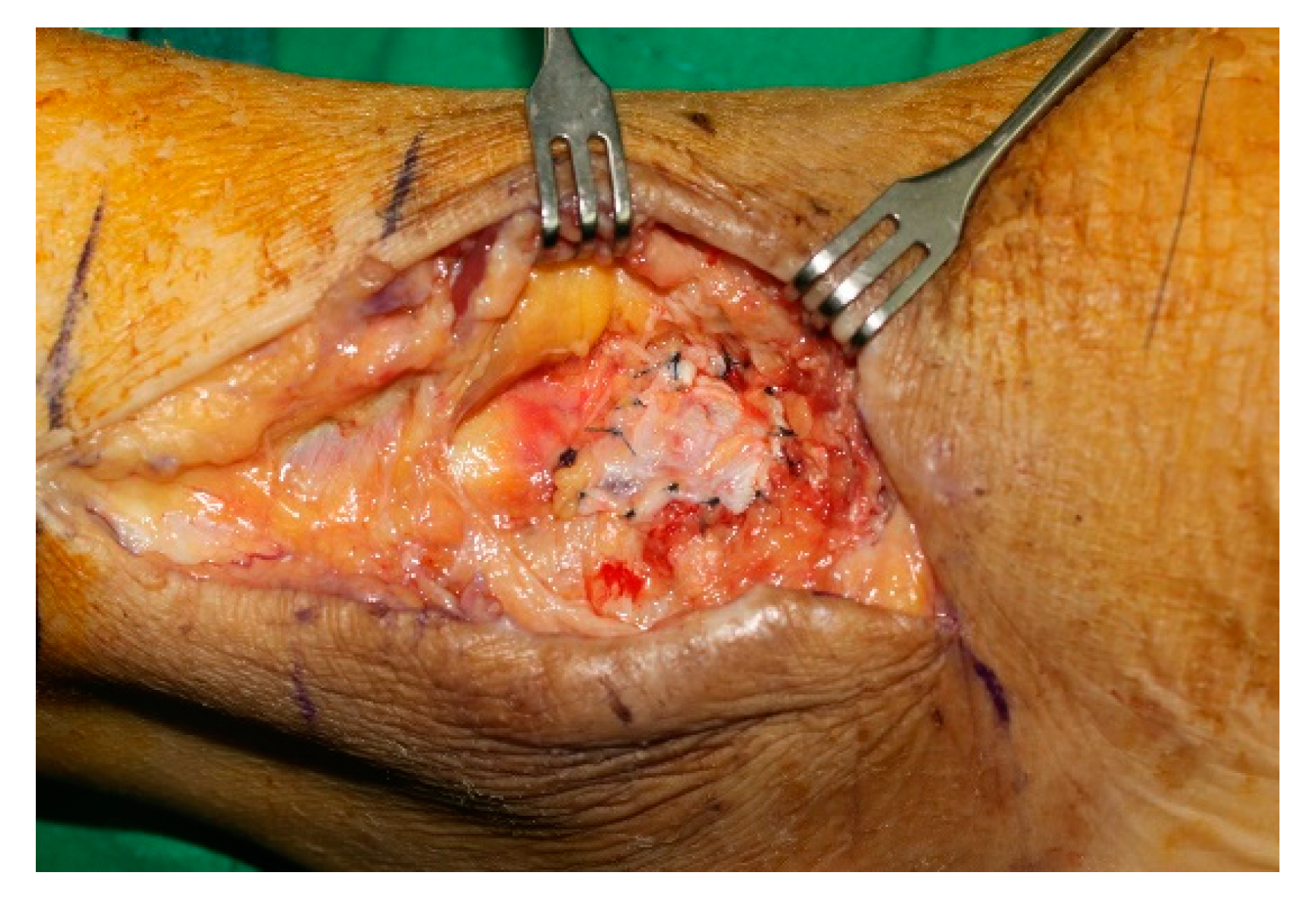 Jcm 11 06215 g006 Jcm 11 06215 g006