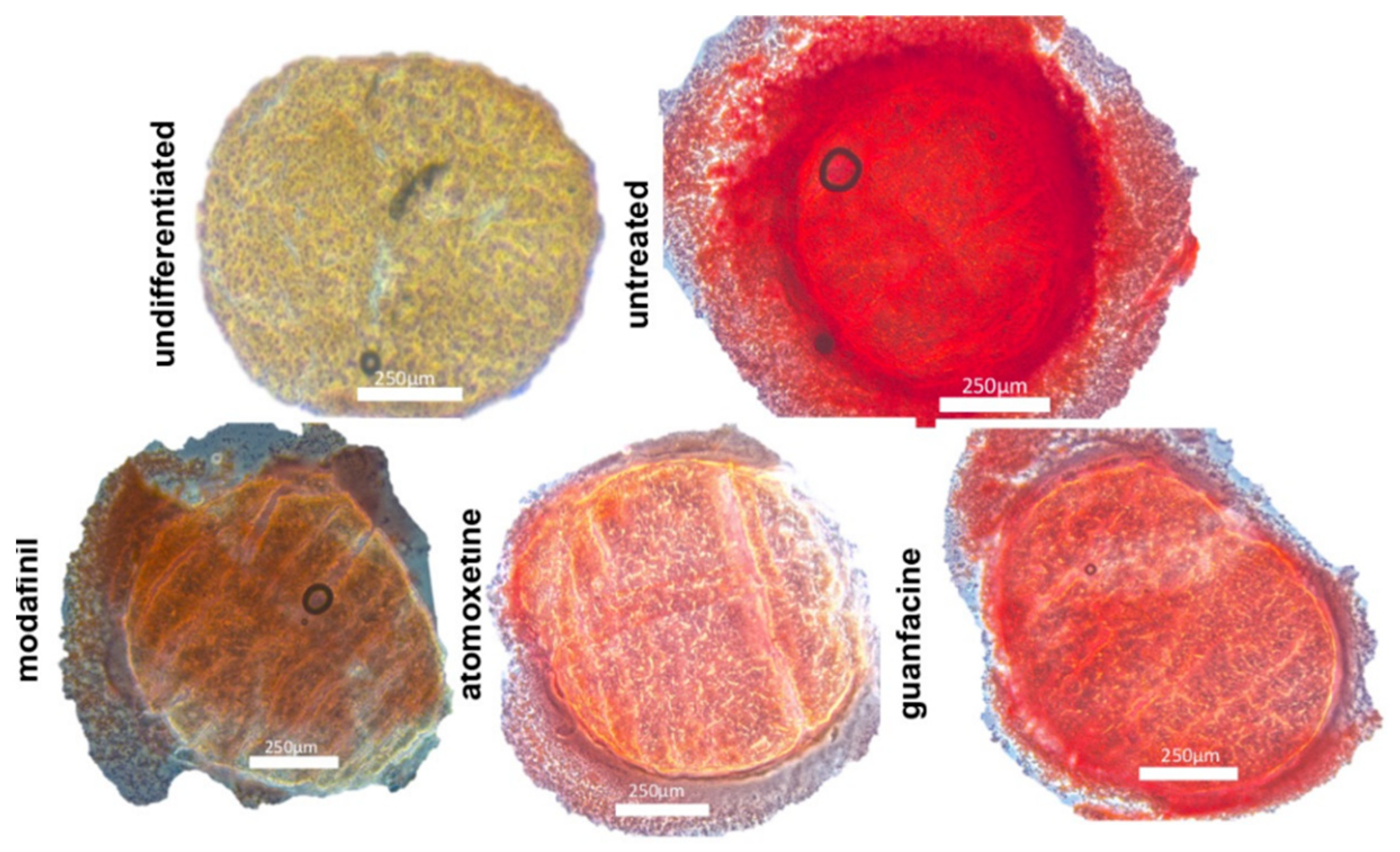 Jcm 11 06218 g006 Jcm 11 06218 g006
