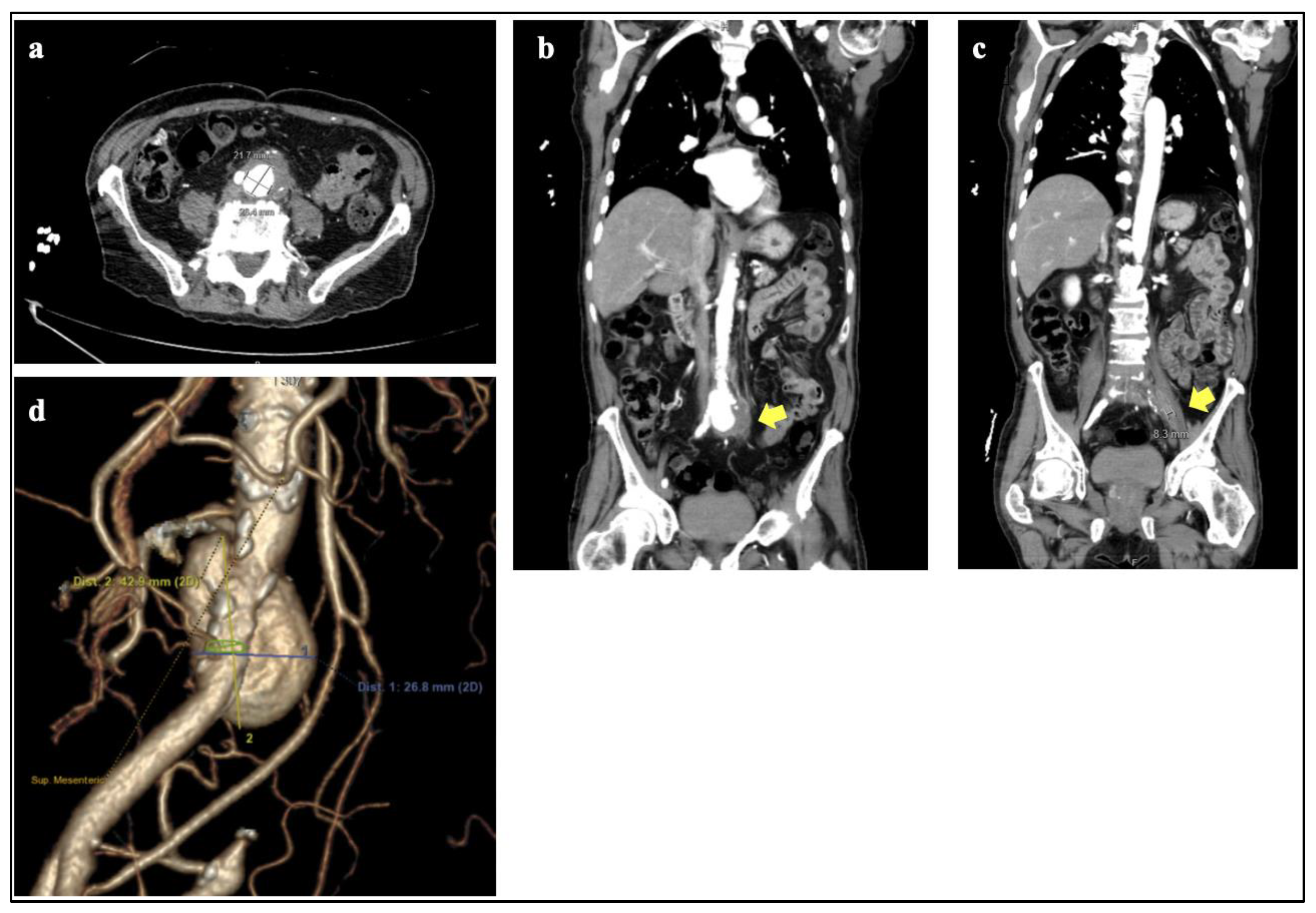 Jcm 11 06226 g001 Jcm 11 06226 g001