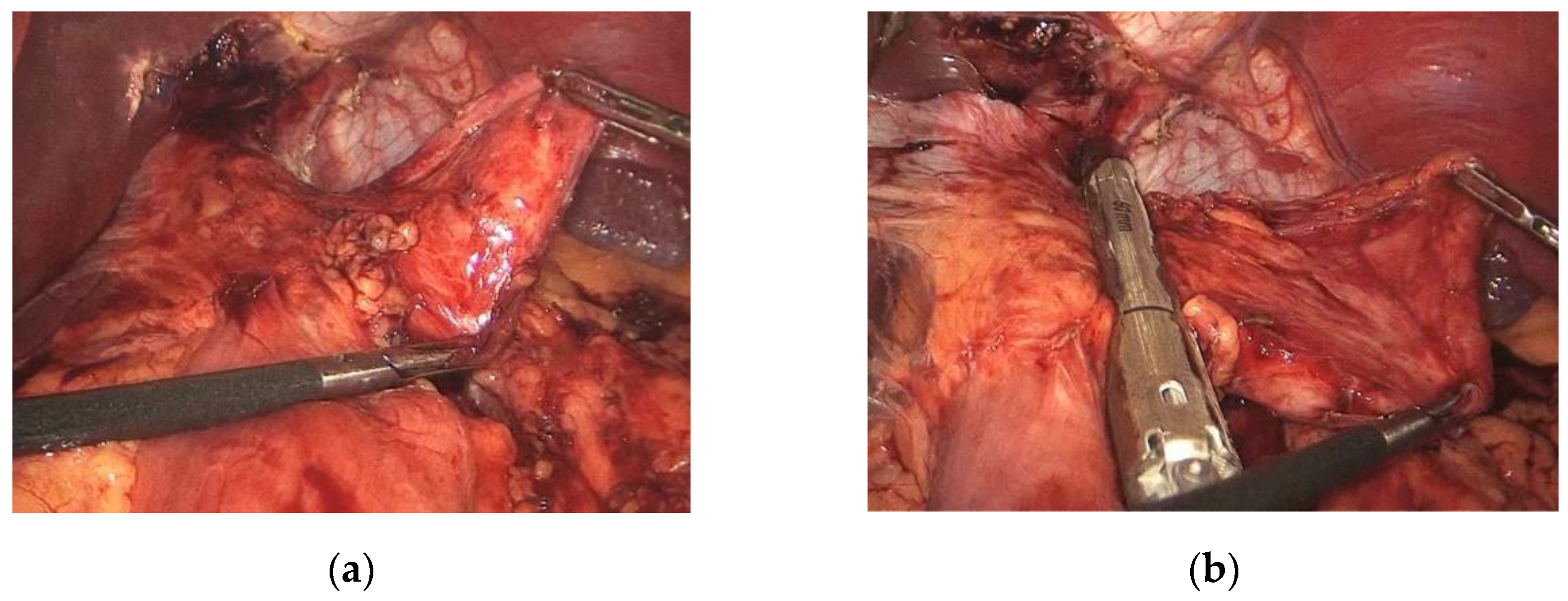 Jcm 11 06238 g001 Jcm 11 06238 g001