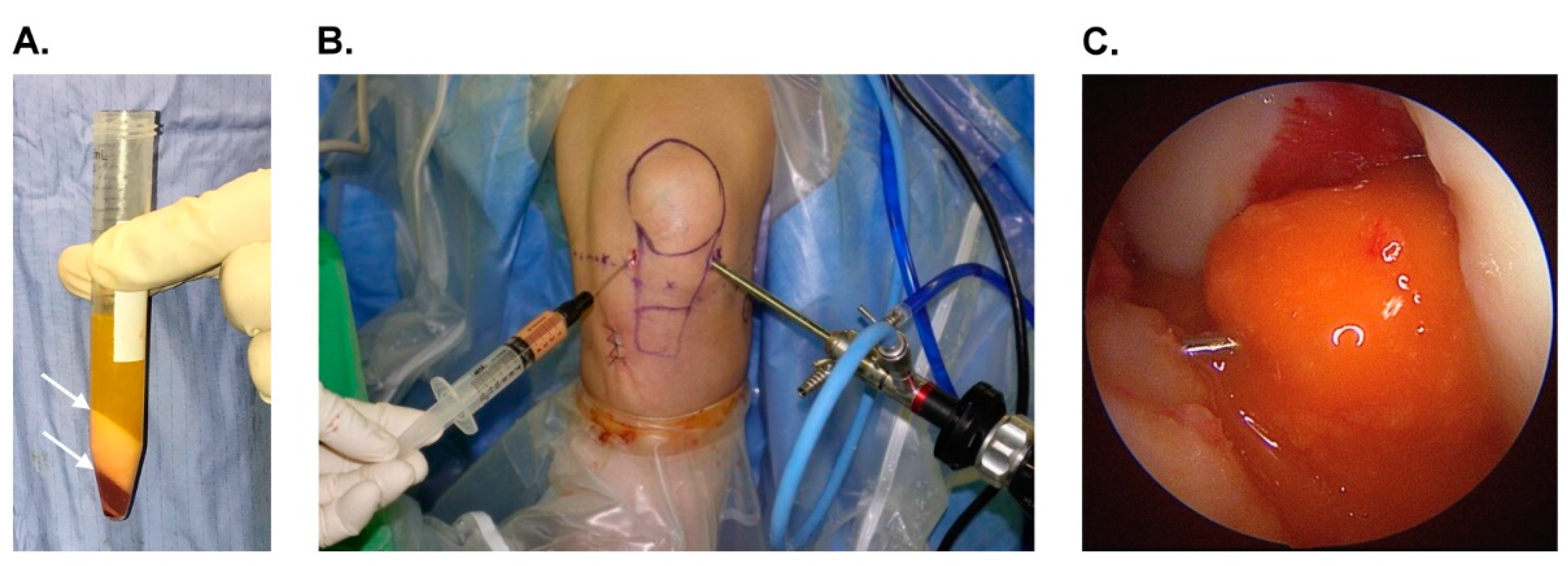 Jcm 11 06240 g002 Jcm 11 06240 g002