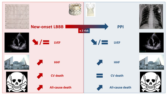 Delayed Total Atrioventricular Block After Transcatheter Aortic Valve  Replacement Assessed by Implantable Loop Recorders