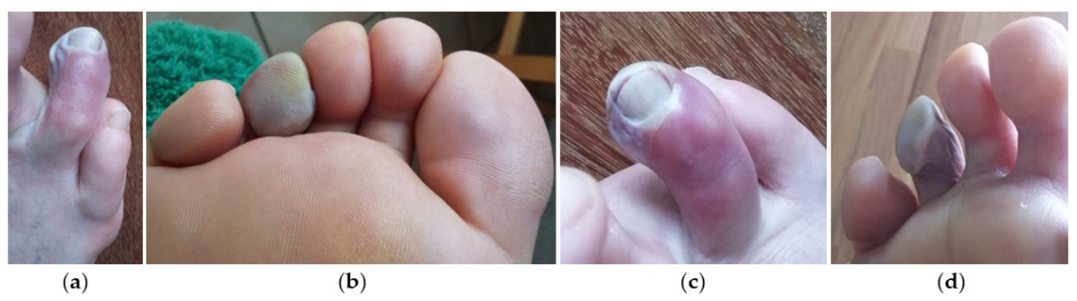 Jcm 11 06263 g002 Jcm 11 06263 g002