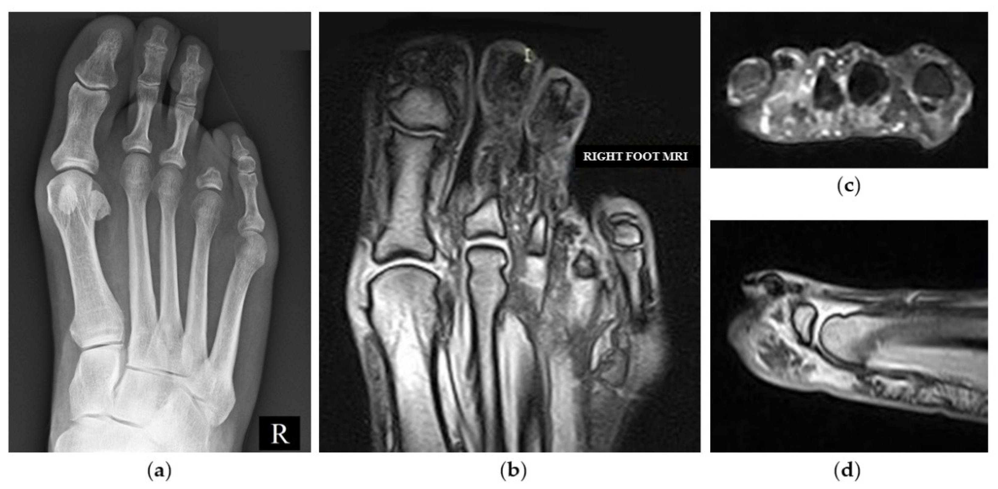 Jcm 11 06263 g004 Jcm 11 06263 g004