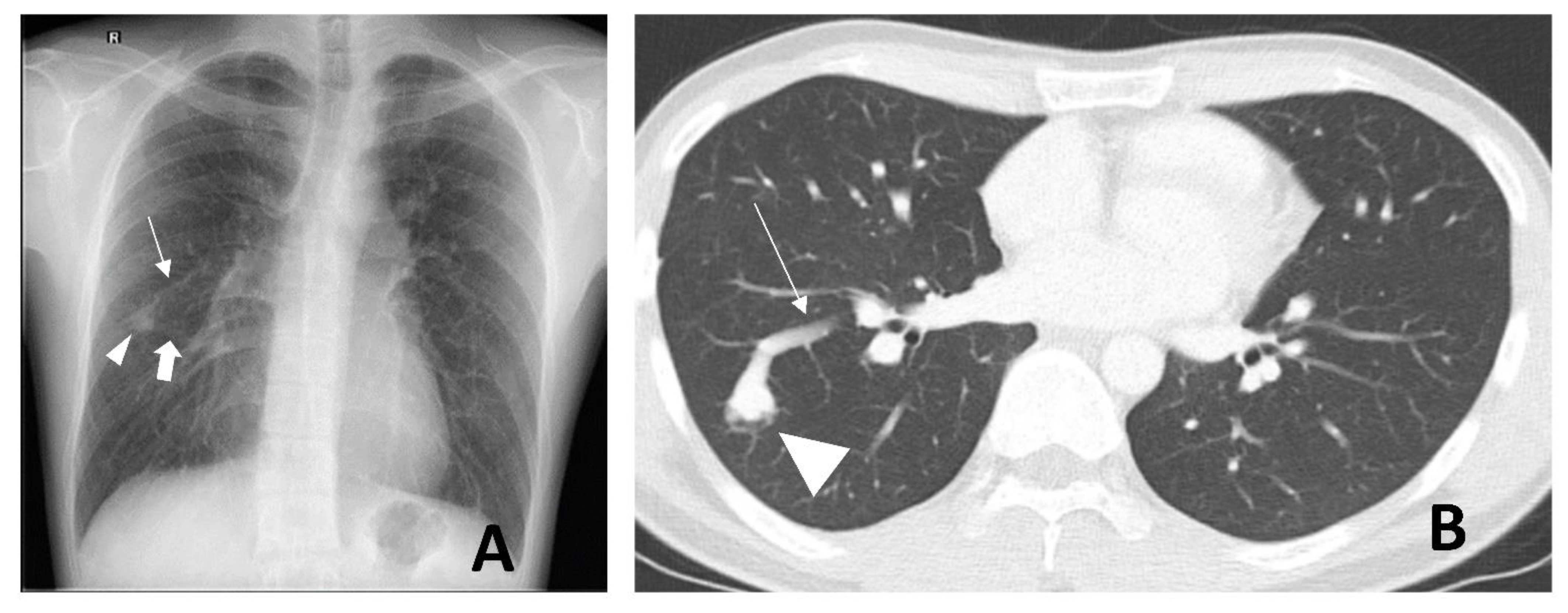 Jcm 11 06282 g001 Jcm 11 06282 g001