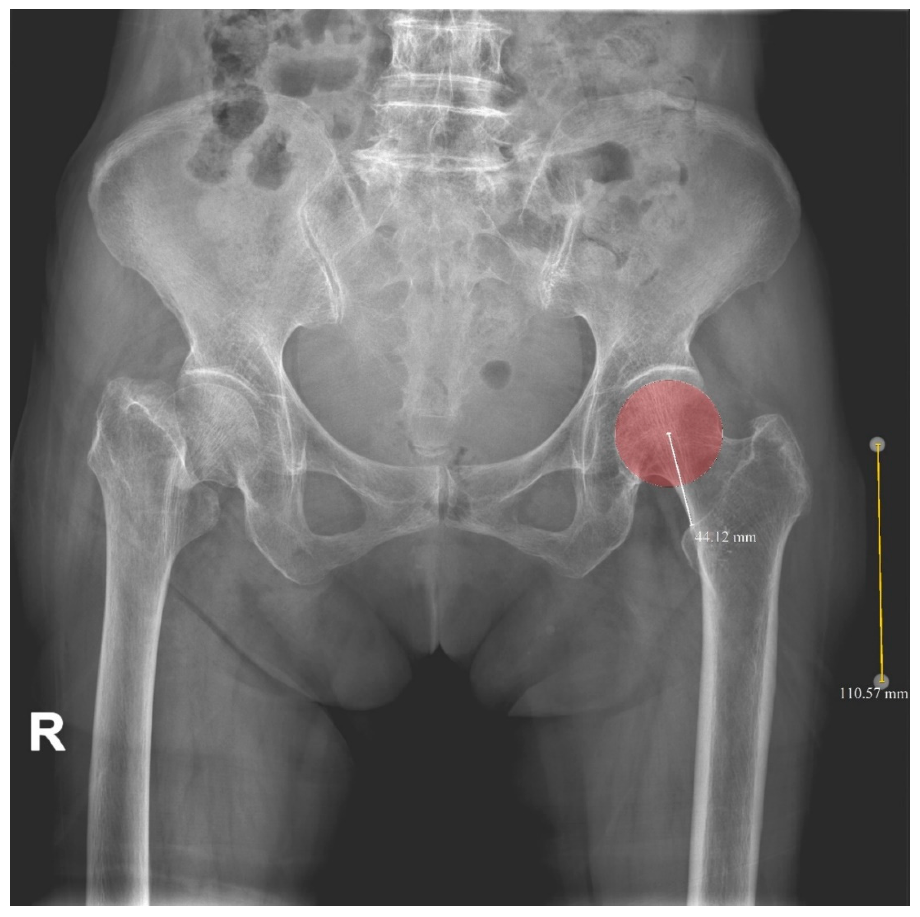 Jcm 11 06303 g004 Jcm 11 06303 g004