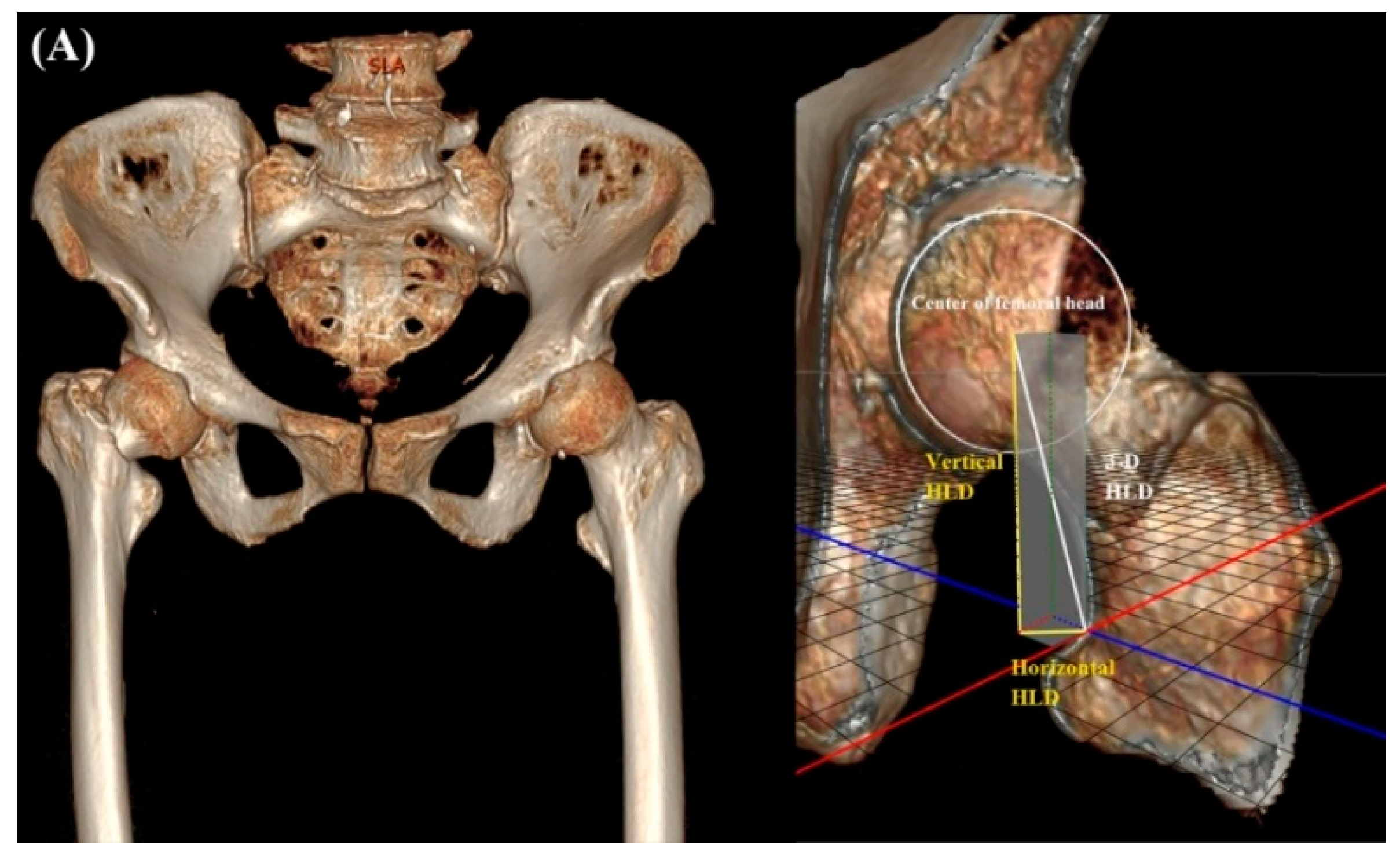 Jcm 11 06303 g005a Jcm 11 06303 g005a