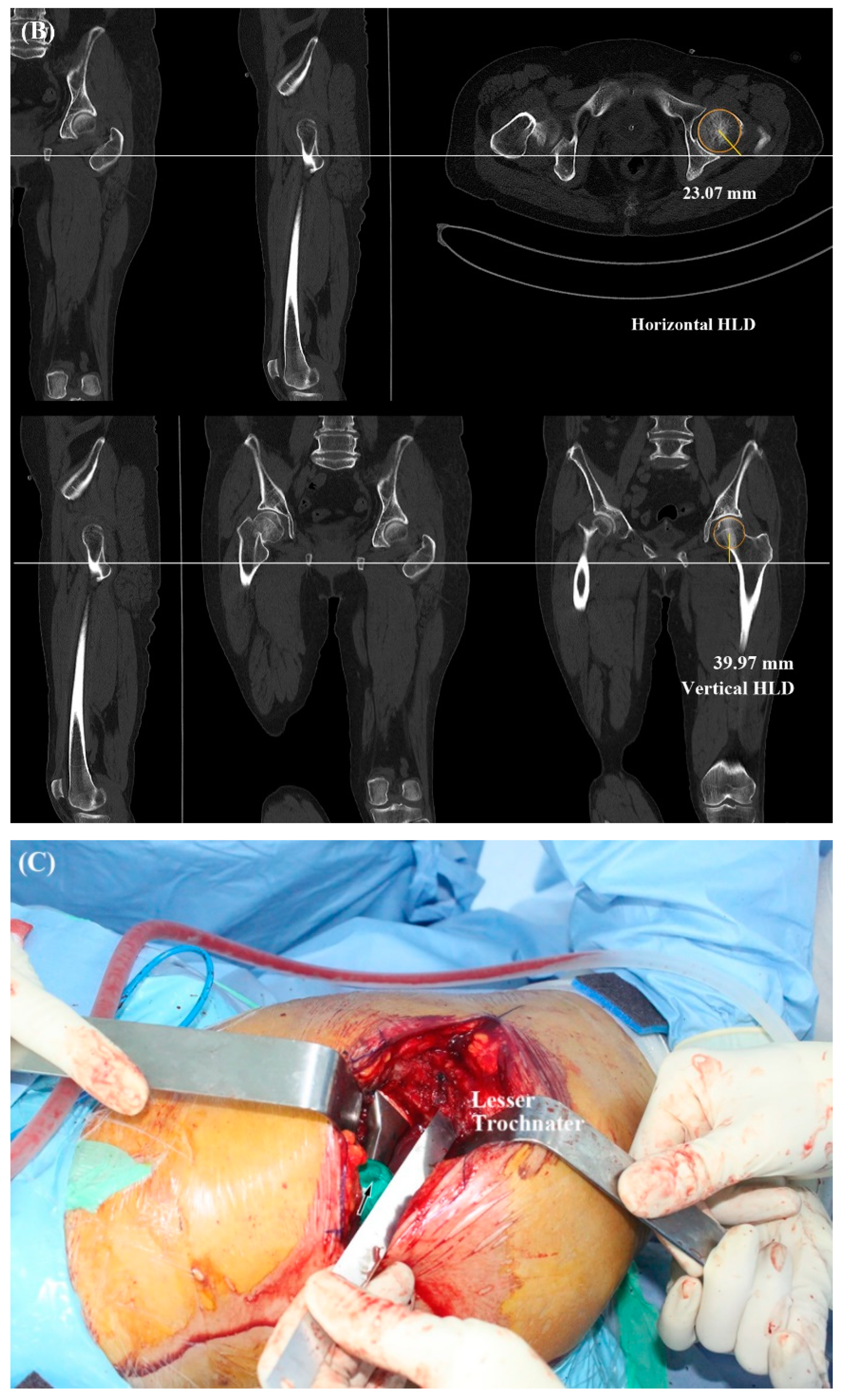 Jcm 11 06303 g005b Jcm 11 06303 g005b