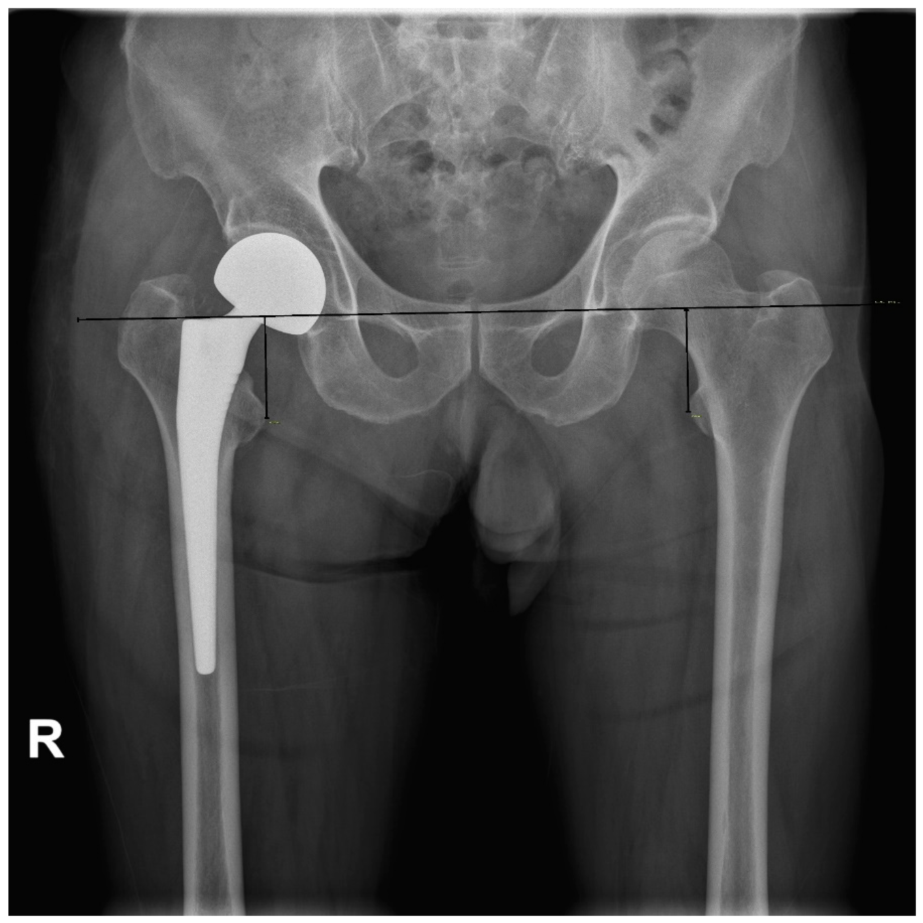 Jcm 11 06303 g006 Jcm 11 06303 g006