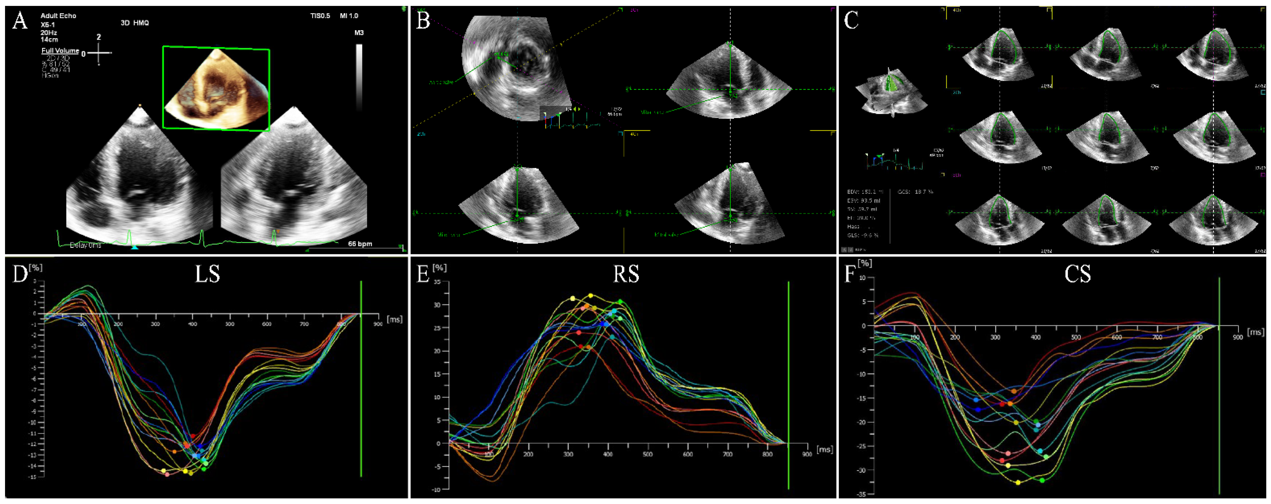 Normal range of myocardial layer-specific strain using two-dimensional  speckle tracking echocardiography