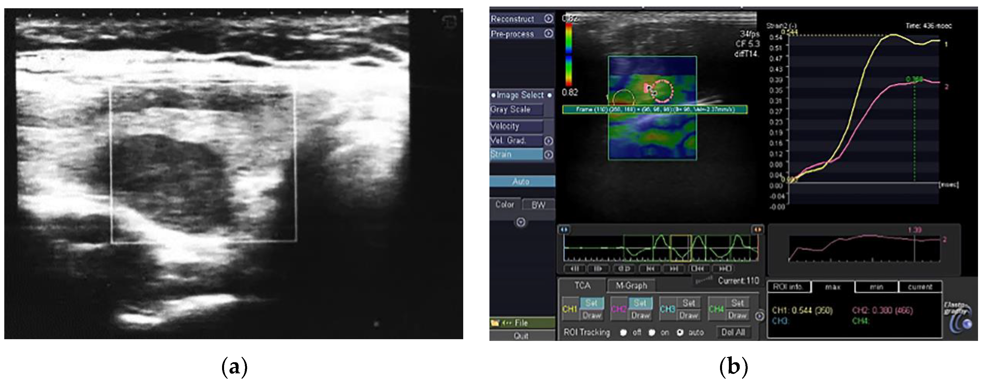Jcm 11 06339 g001 Jcm 11 06339 g001
