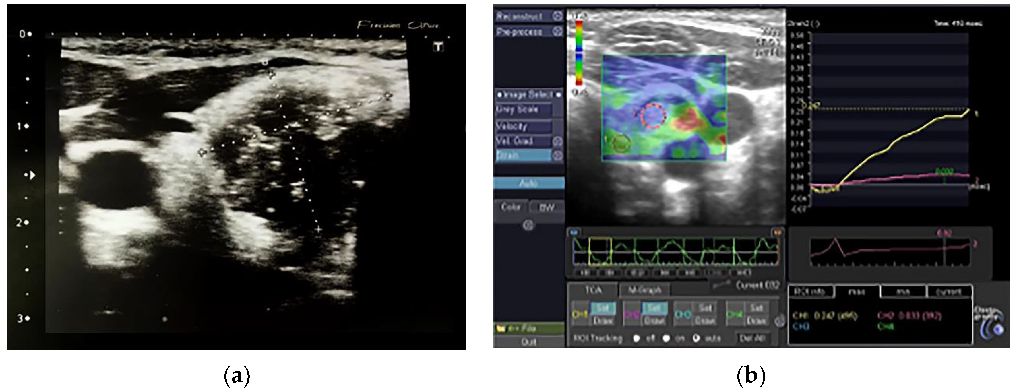 Jcm 11 06339 g002 Jcm 11 06339 g002