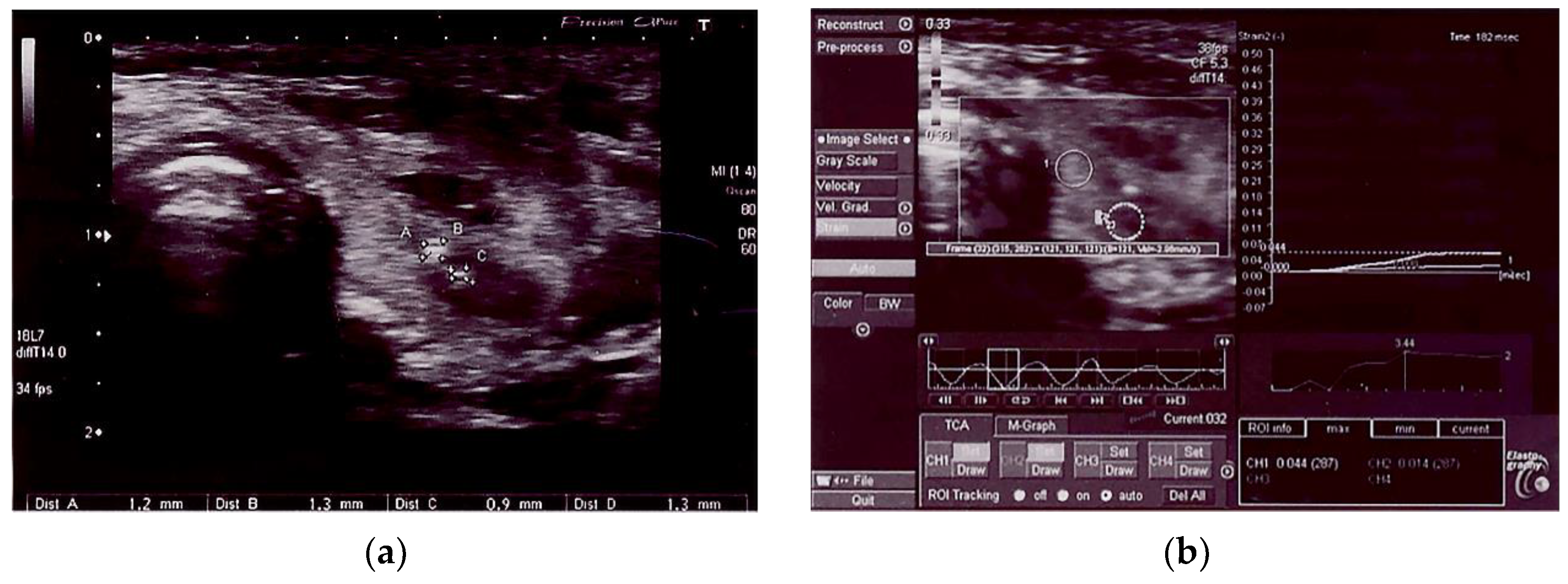 Jcm 11 06339 g003 Jcm 11 06339 g003