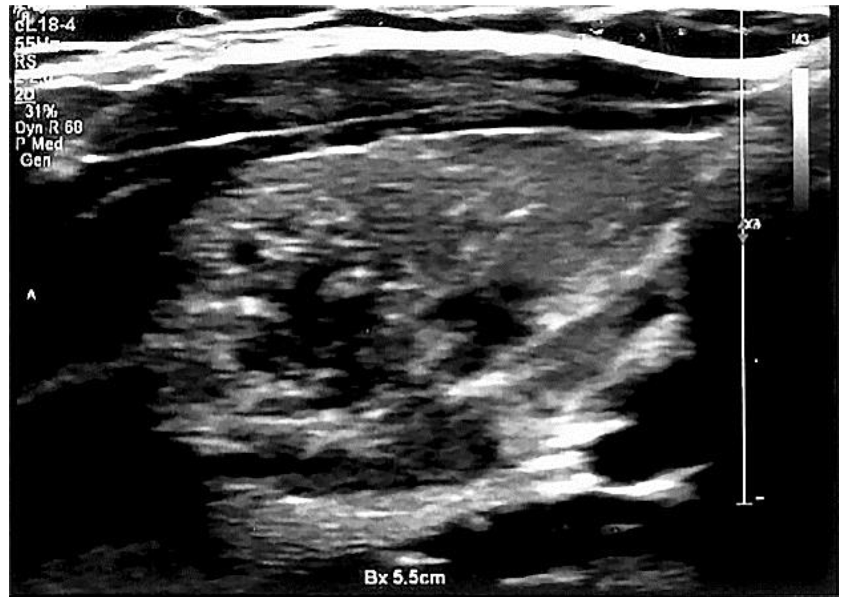 Jcm 11 06339 g004 Jcm 11 06339 g004