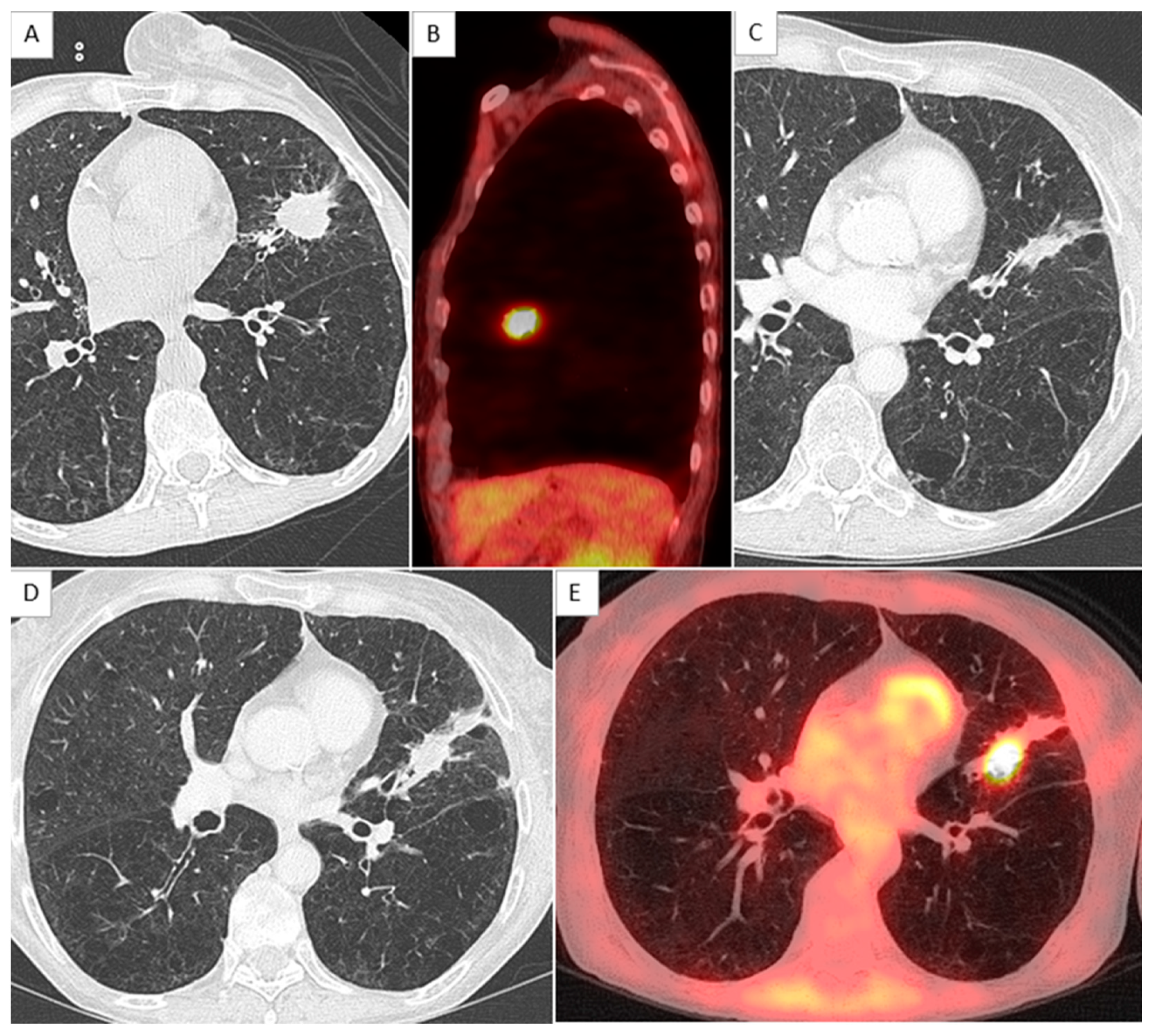 Jcm 11 06445 g003 Jcm 11 06445 g003