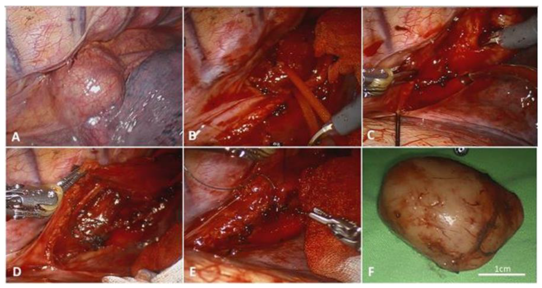 Jcm 11 06471 g001 Jcm 11 06471 g001